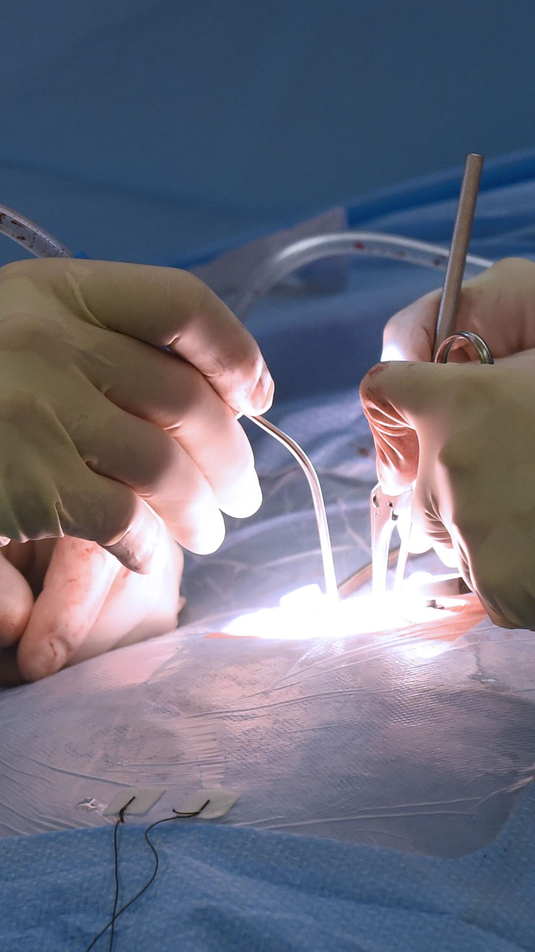 Die Studie kommt aus Österreich.