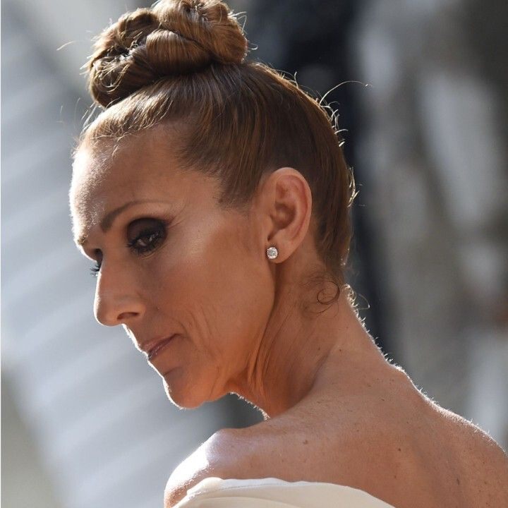 "Schwere und anhaltenden Muskelkrämpfe" machen Auftritte von Céline Dion aktuell unmöglich