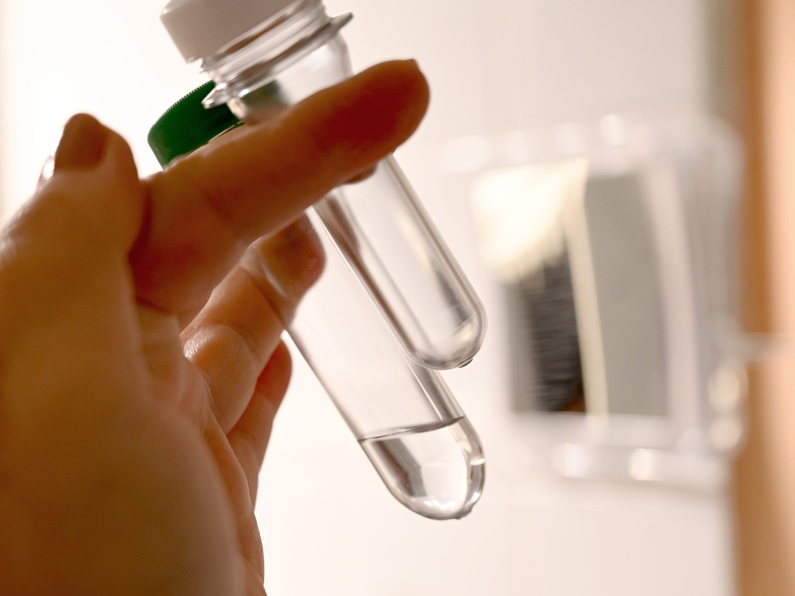 Weiterhin teils große Verzögerungen bei PCR-Auswertung in NÖ Weiterhin teils große Verzögerungen bei PCR-Auswertung in NÖ