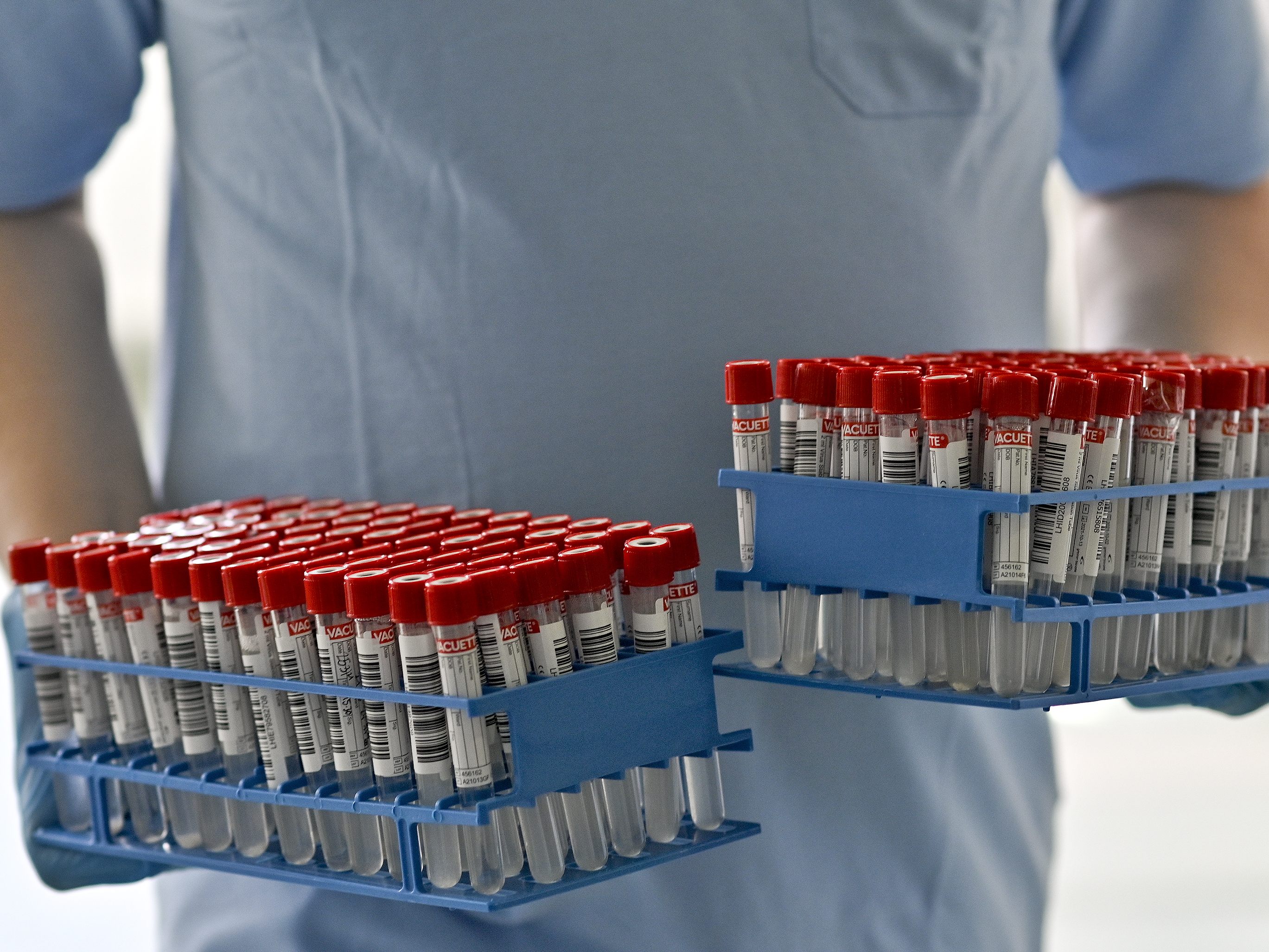 Die zwei größten Corona-Cluster Niederösterreichs entfallen auf Unternehmen. Die zwei größten Corona-Cluster Niederösterreichs entfallen auf Unternehmen.
