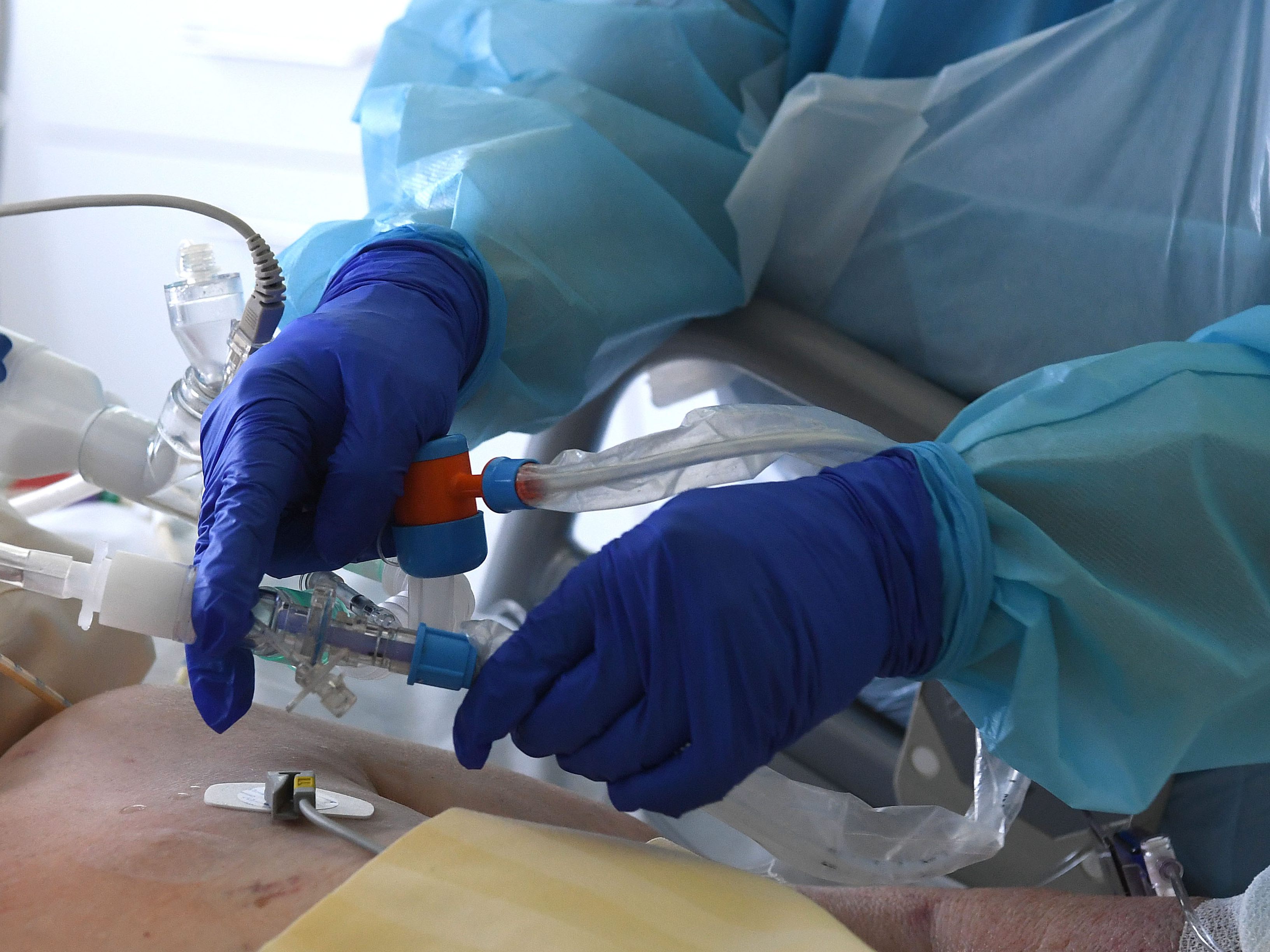Zahlreiche Corona-Intensivpatienten gibt es in Niederösterreich. Zahlreiche Corona-Intensivpatienten gibt es in Niederösterreich.