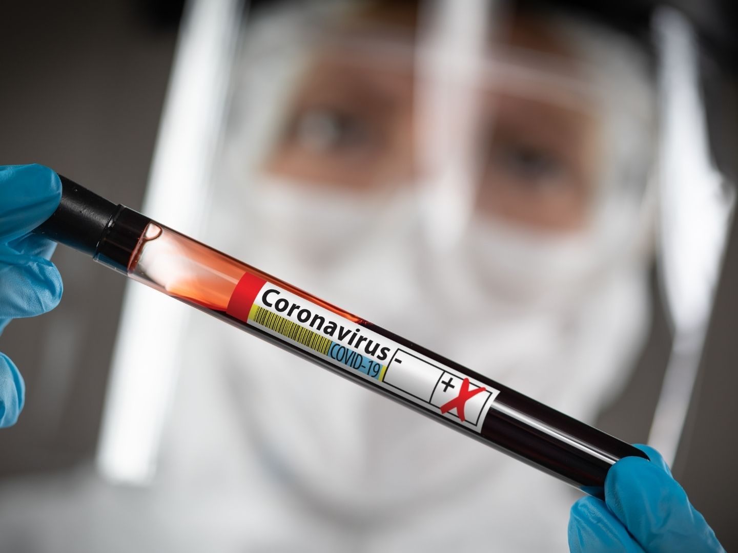 Der PCR-Test des Omikron-Verdachtsfalls ist positiv. Der PCR-Test des Omikron-Verdachtsfalls ist positiv.
