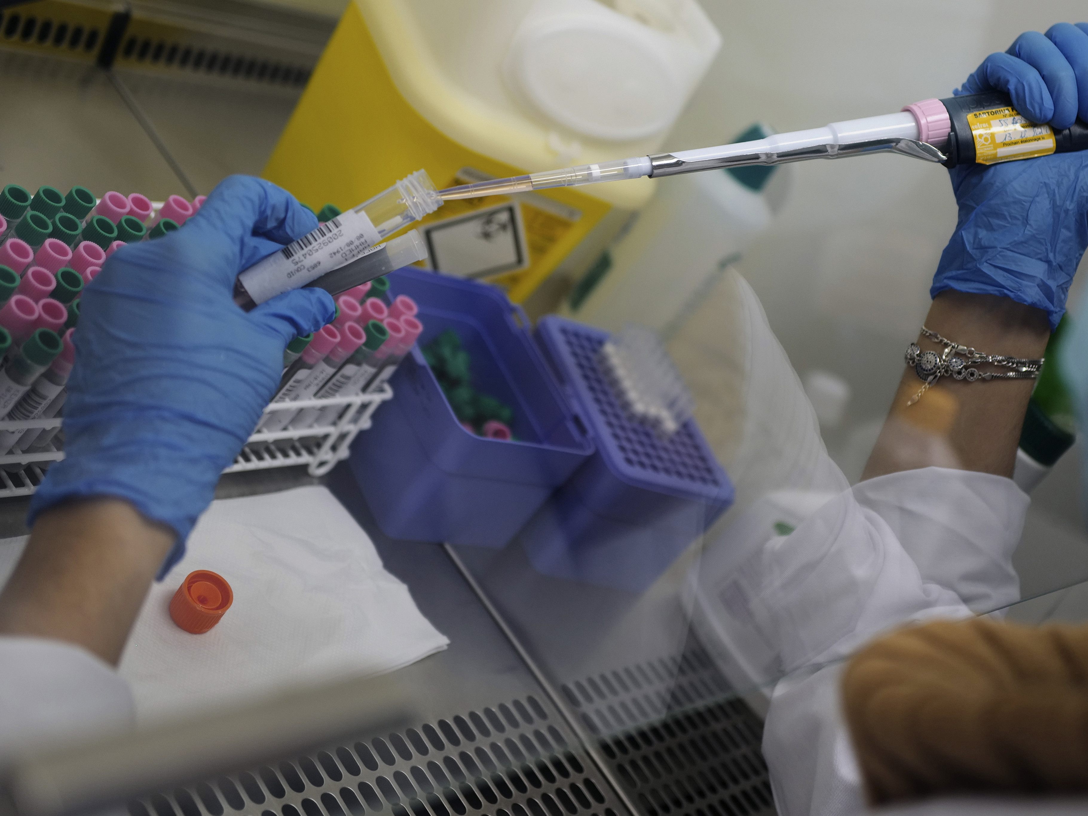 Mehr als 2.500 positive Corona-Tests wurden am Donnerstag in NÖ gemeldet. Mehr als 2.500 positive Corona-Tests wurden am Donnerstag in NÖ gemeldet.