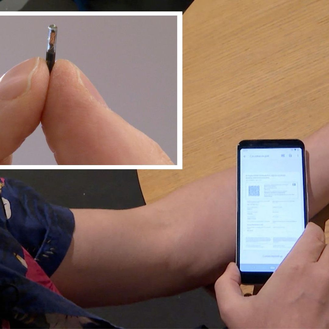 So klein ist der Chip, der implantiert wird.