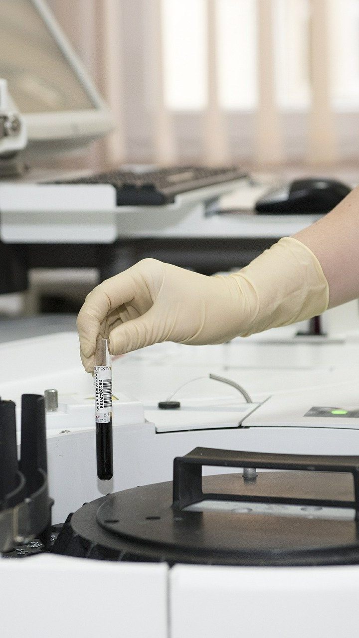 Covid-19-Blutgerinnsel sind besonders gefährlich - eine unternationale Studie dazu wurde durchgeführt