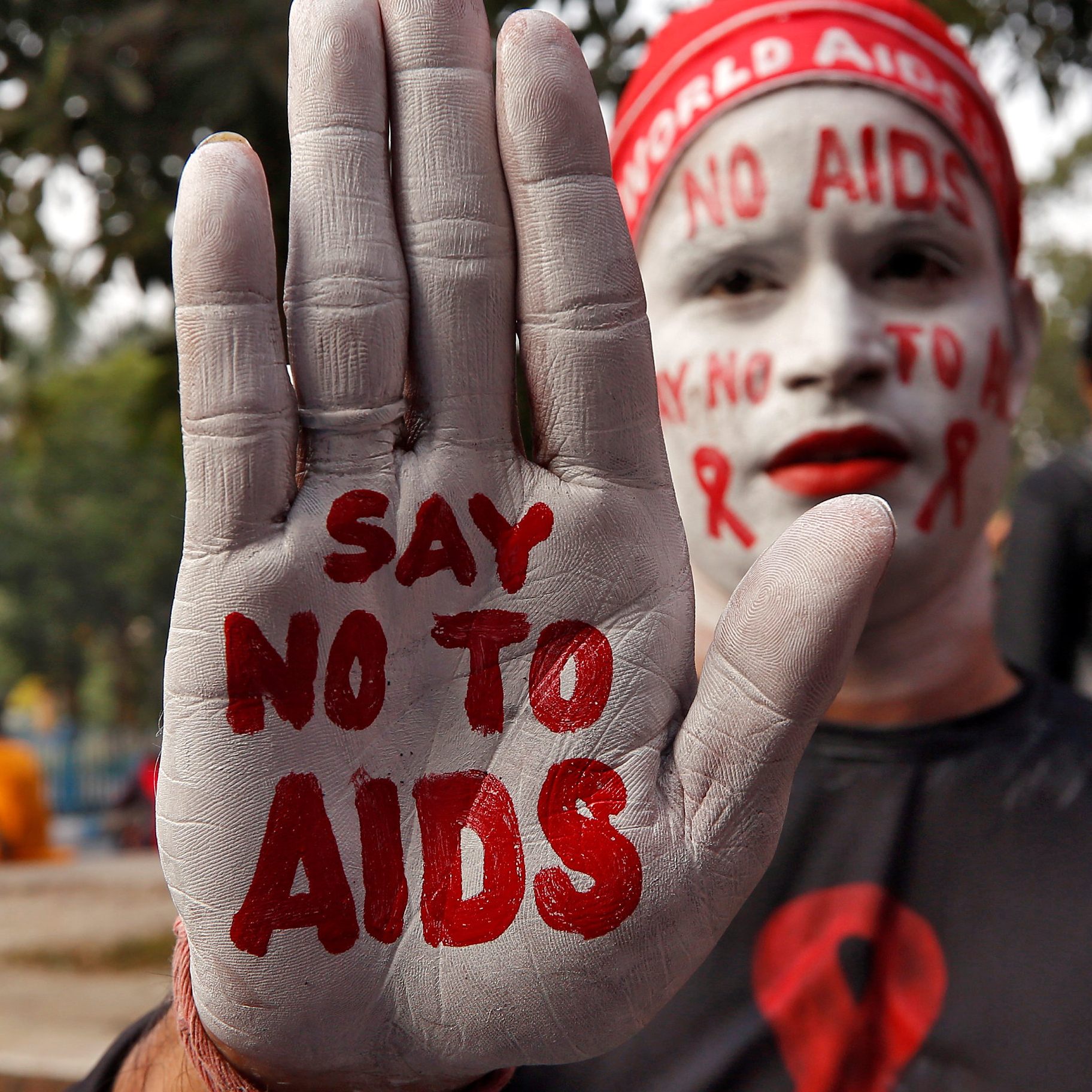 Ein Impfstoff gegen AIDS könnte das Blatt wenden.