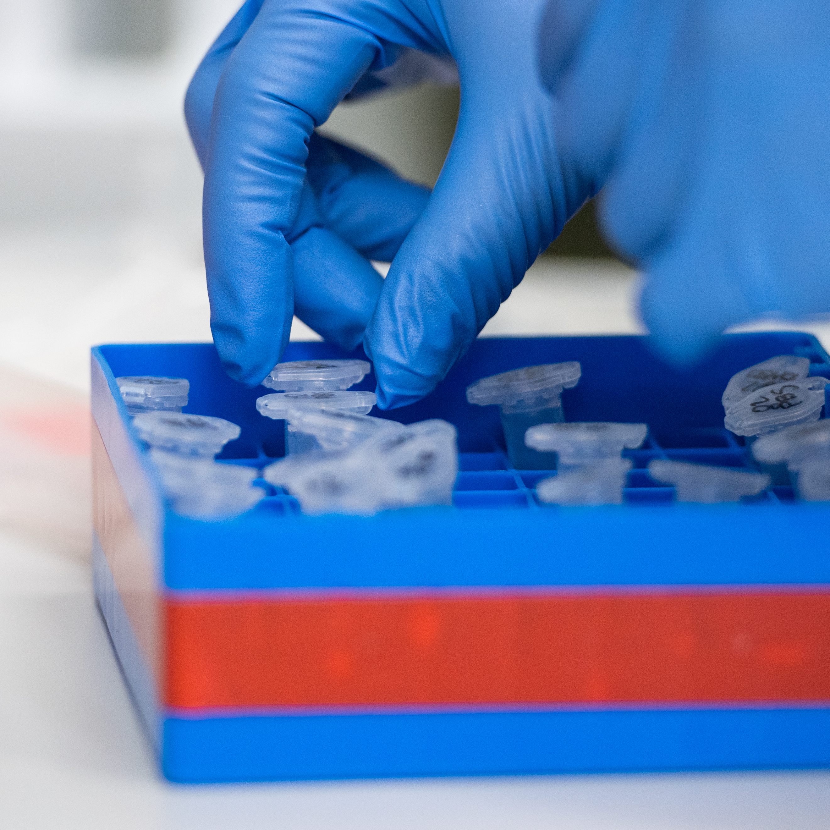 Schweizer Forscher entdeckten einen Signalweg, der verantwortlich sein könnte für die Entstehung von Entzündungen nach einer Covid-19-Erkrankung.