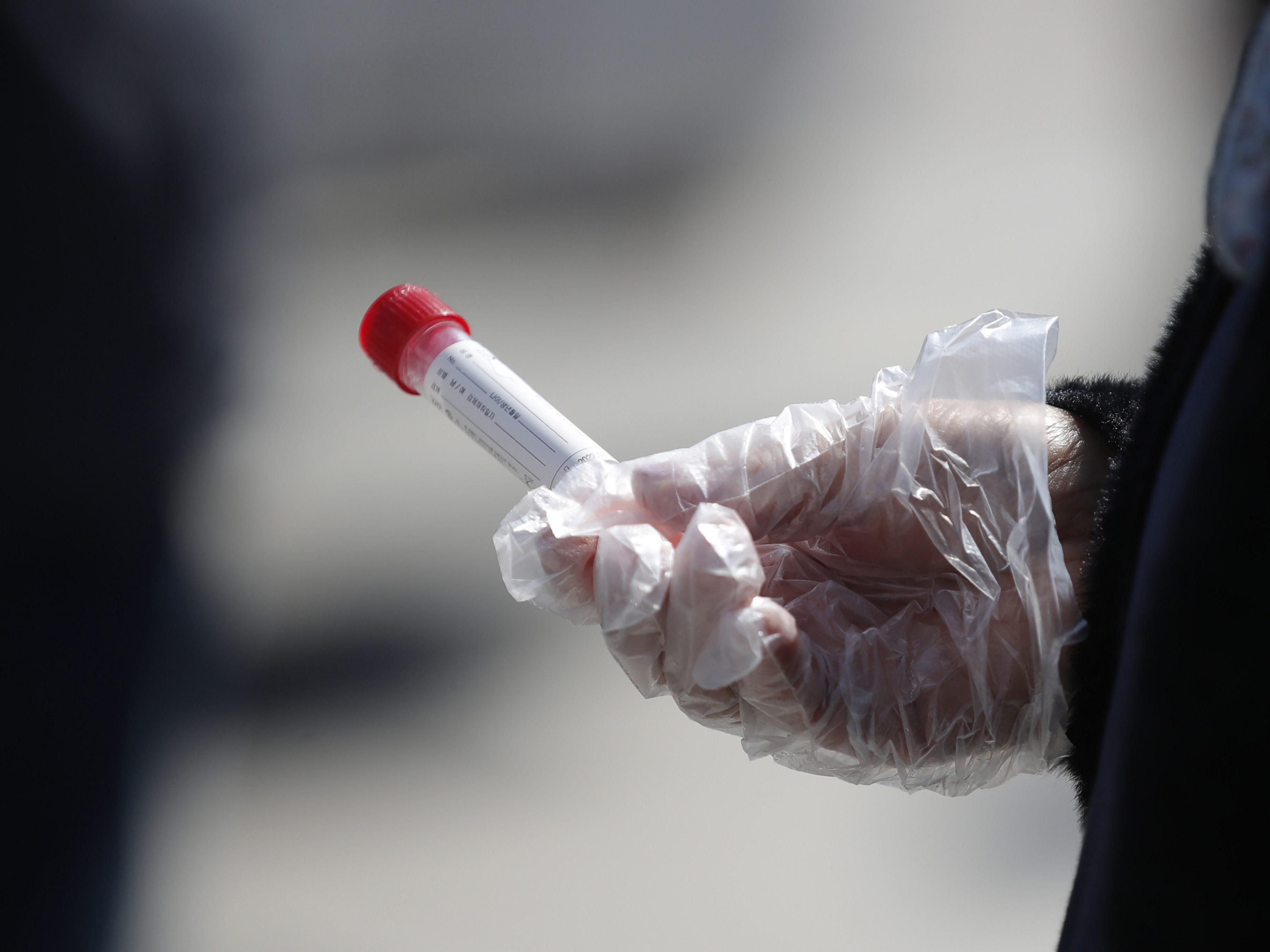 Deutschland verkürzte Genesenenstatus auf drei Monate. Deutschland verkürzte Genesenenstatus auf drei Monate.