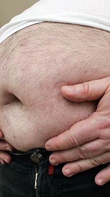 Trotz Diättrends nimmt Adipositas zu