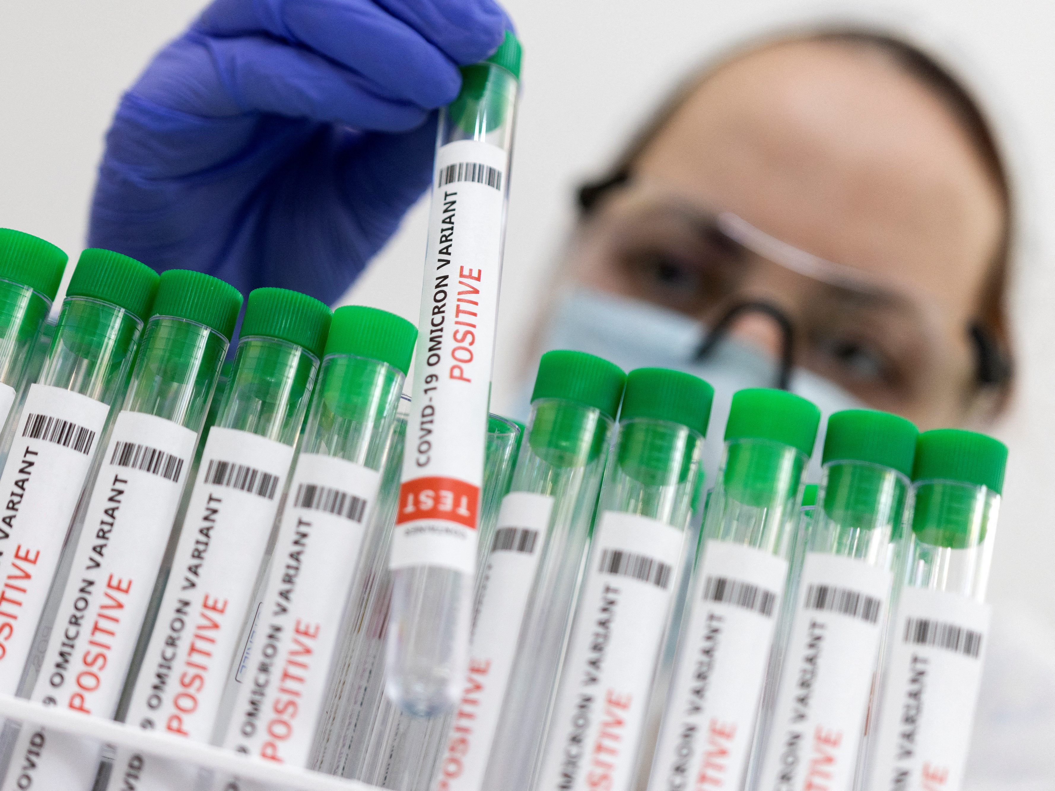 Seit Pandemiebeginn wurden in Österreich 2,6 Millionen Infektionen registriert. Seit Pandemiebeginn wurden in Österreich 2,6 Millionen Infektionen registriert.