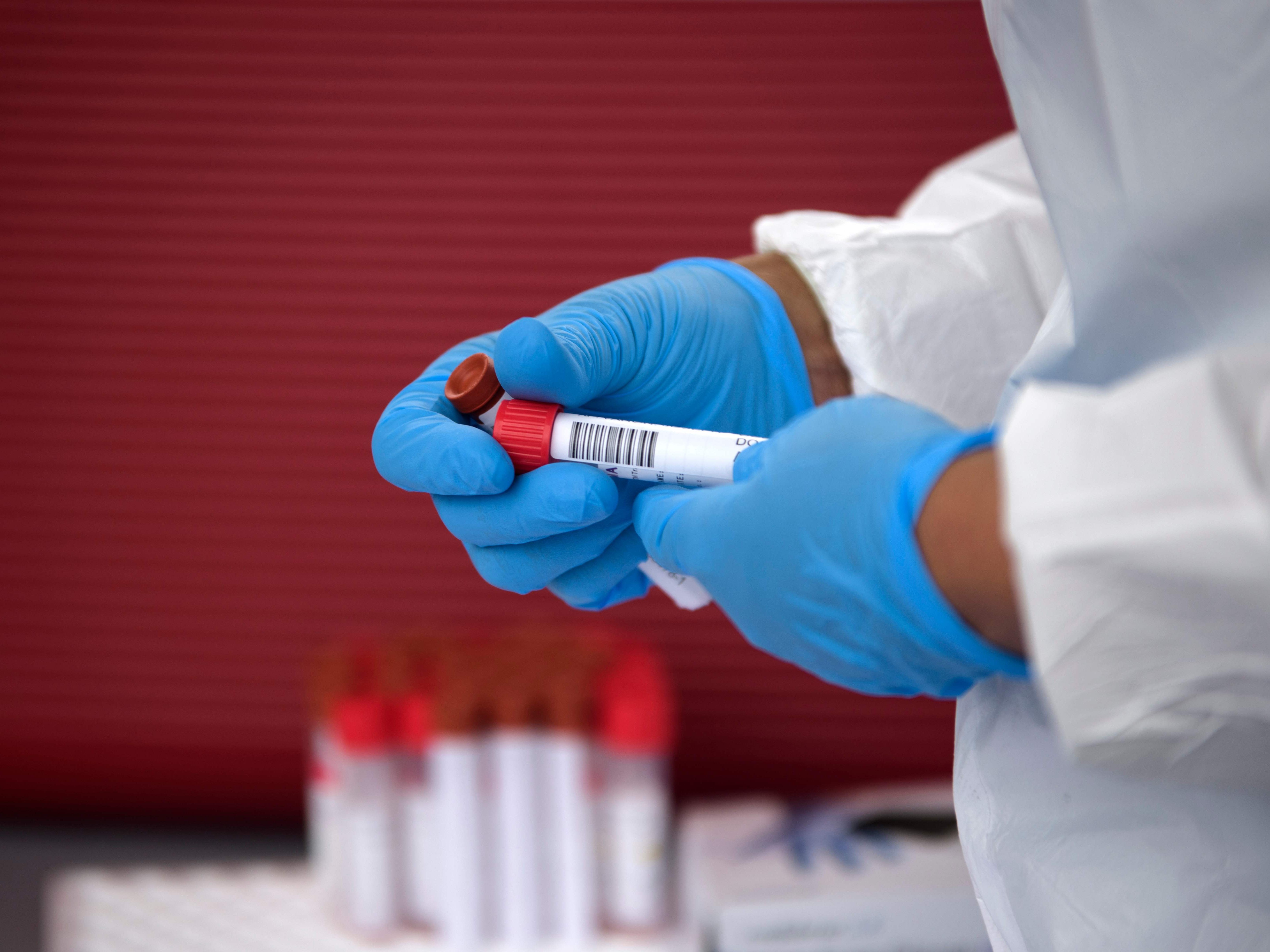 21,7 Prozent der Ungeimpften und Nicht-Genesenen mit dem Coronavirus infiziert