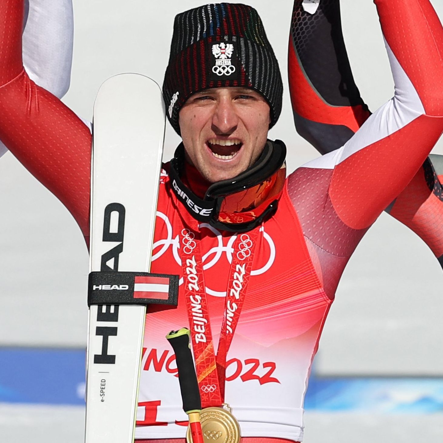 Die glücklichen Medaillen-Gewinner