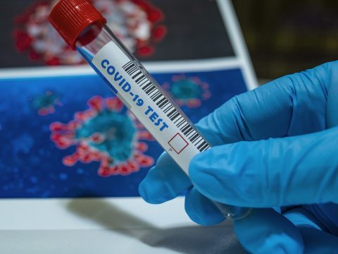 Am Dienstag wurden in Österreich mehr als 25.000 Corona-Infektionen gemeldet. Am Dienstag wurden in Österreich mehr als 25.000 Corona-Infektionen gemeldet.