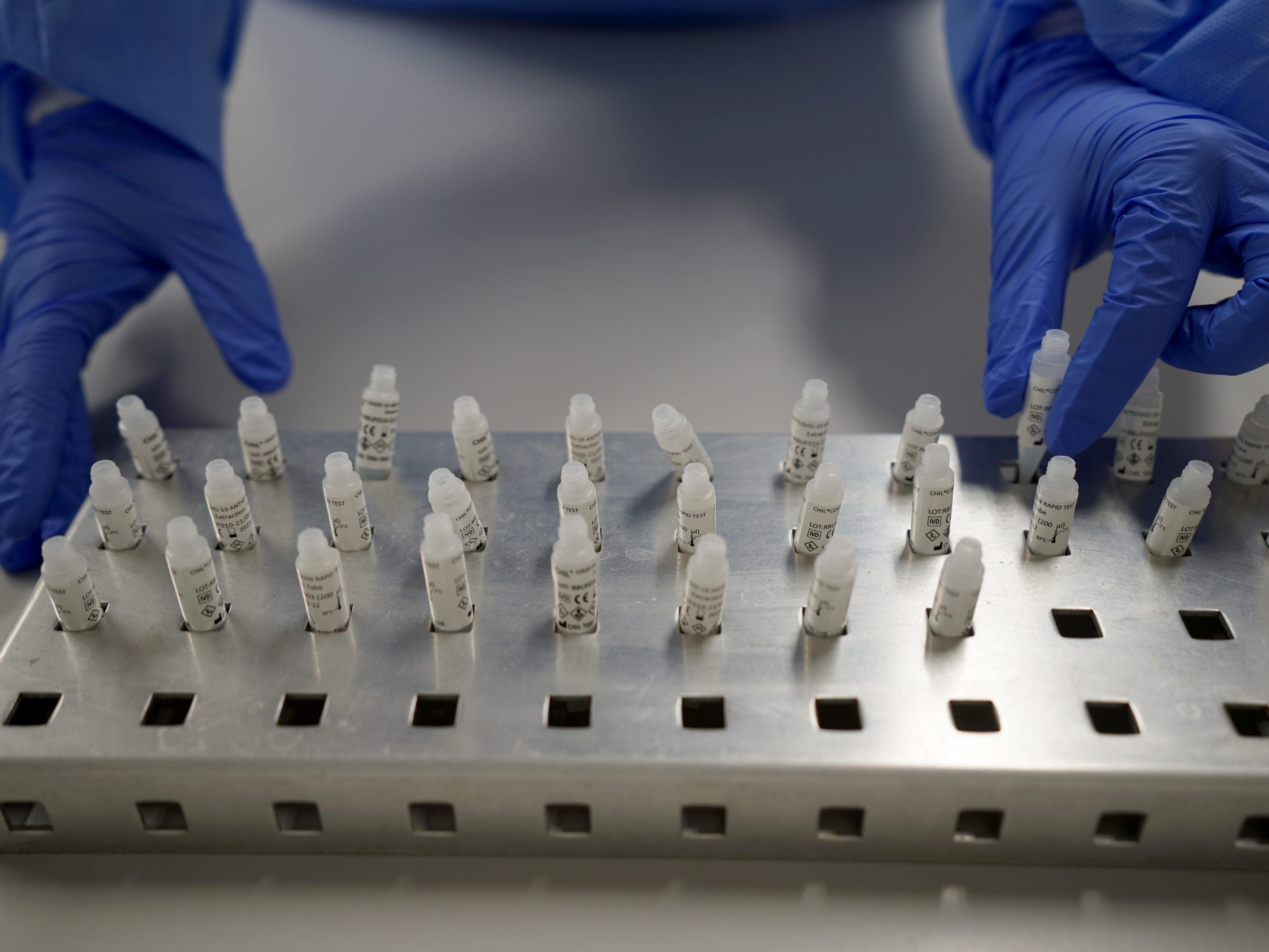 In England hatten mehrere Menschen bereits vier Corona-Infektionen.