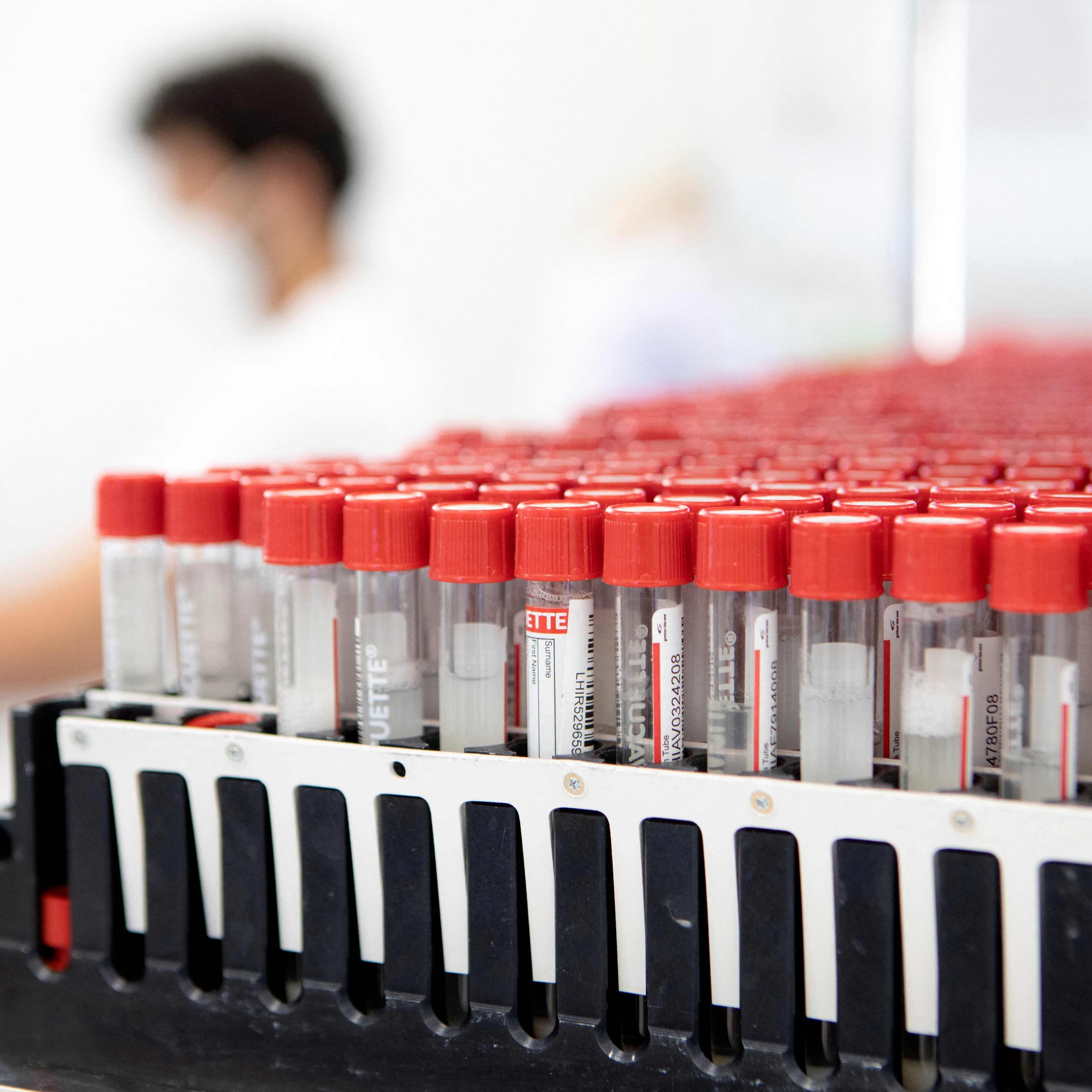 Die Corona-Zahlen in Österreich sind ungebrochen hoch.