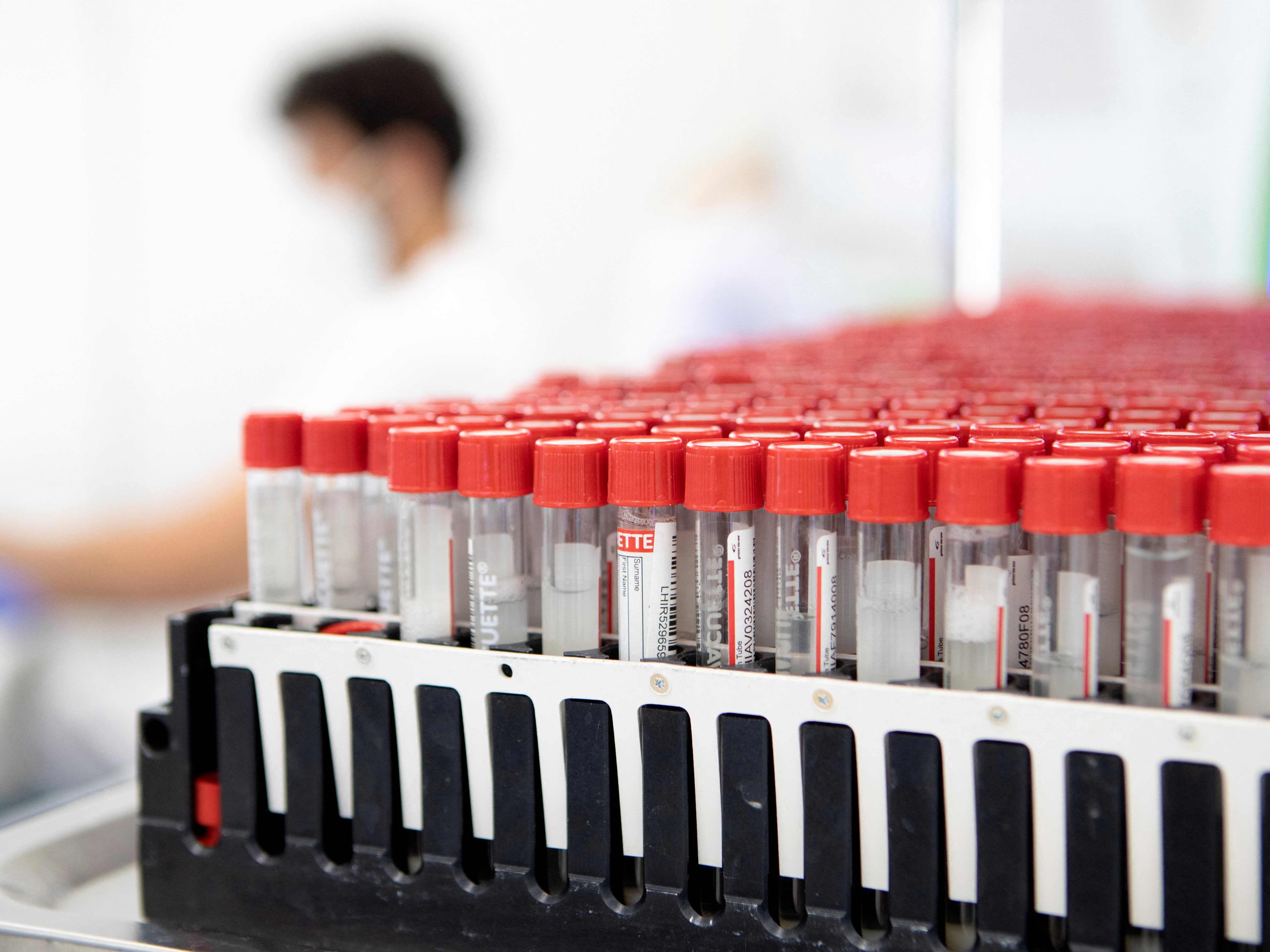Die Coronatest-Verordnung lässt weiter auf sich warten. Die Coronatest-Verordnung lässt weiter auf sich warten.