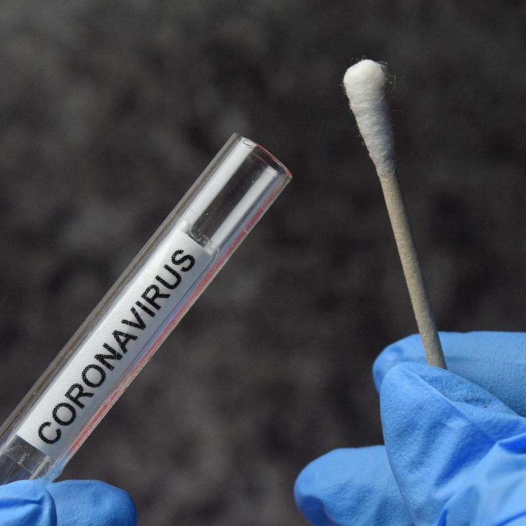 Corona-Zahlen aus Österreich