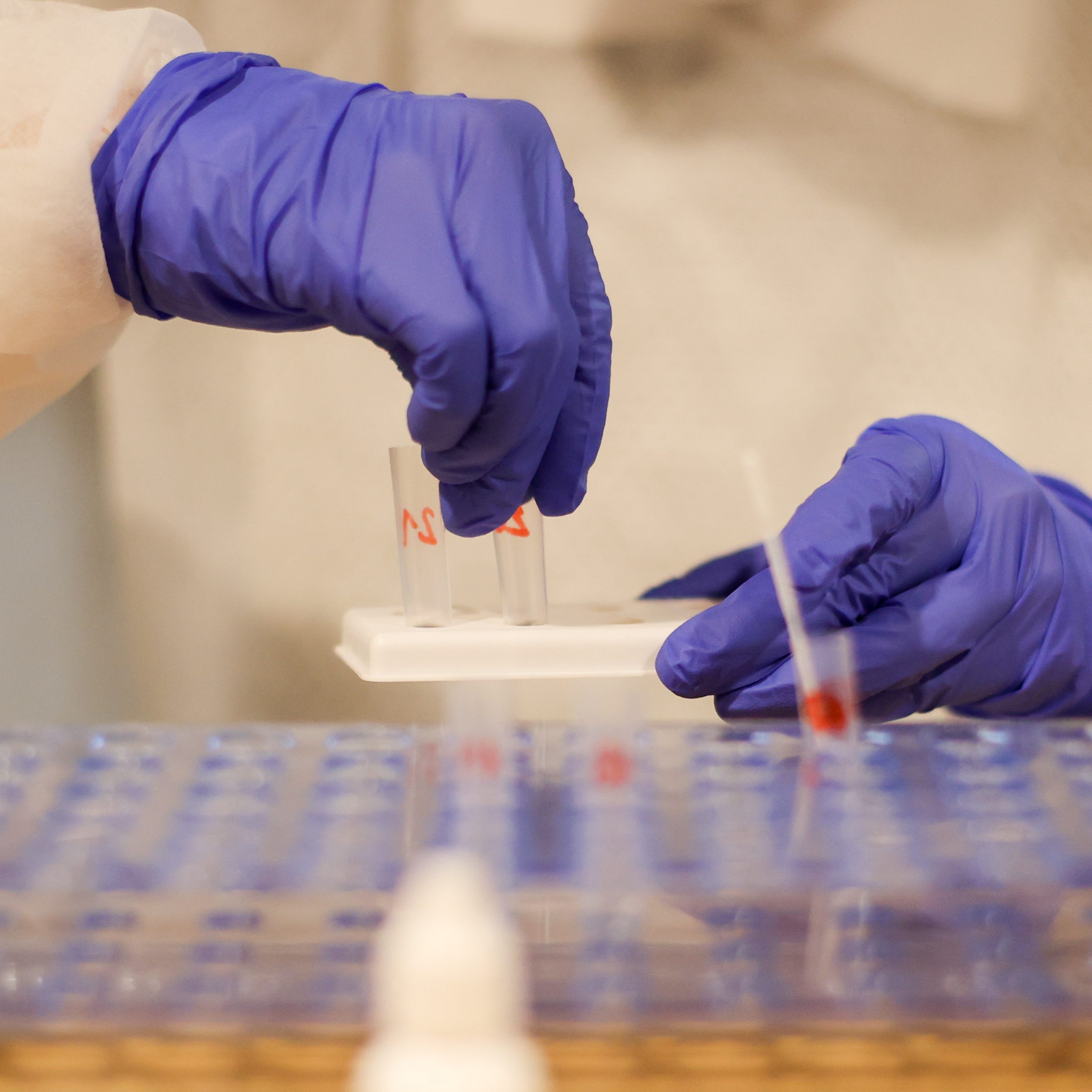 Die Corona-Zahlen in Österreich sind weiter auf hohem Niveau.