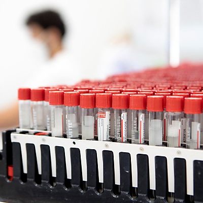 Zahl der entdeckten Corona-Infektionen geht in Österreich zurück