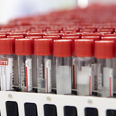 Positiv-Rate der PCR-Tests sei gestern bei 6,3 Prozent