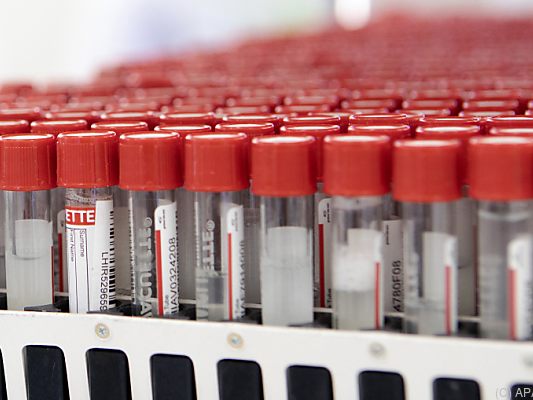 Positiv-Rate der PCR-Tests sei gestern bei 6,3 Prozent