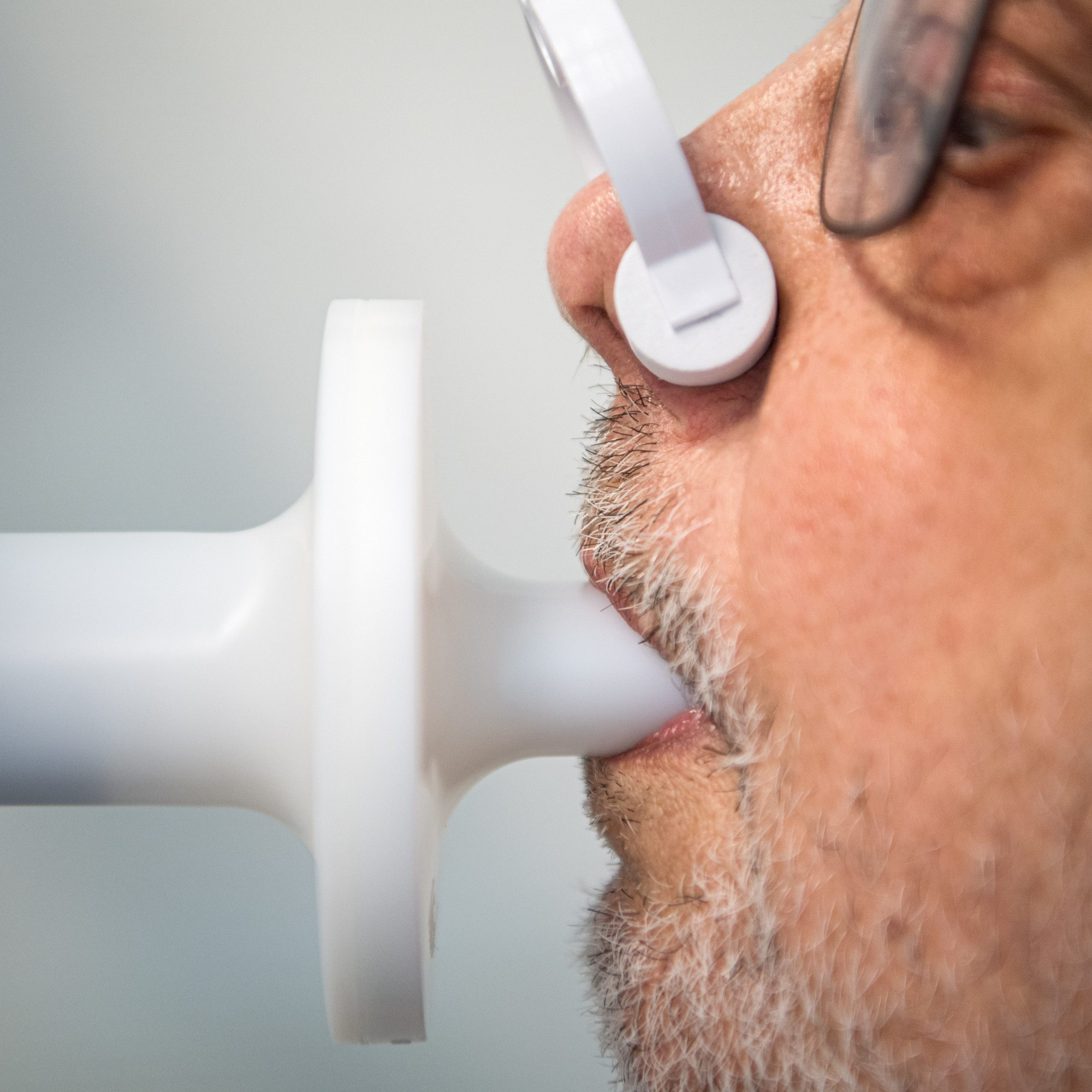 Schweizer Mediziner beobachteten eine neue Form von Lungenfibrose bei hospitalisierten Corona-Patienten.