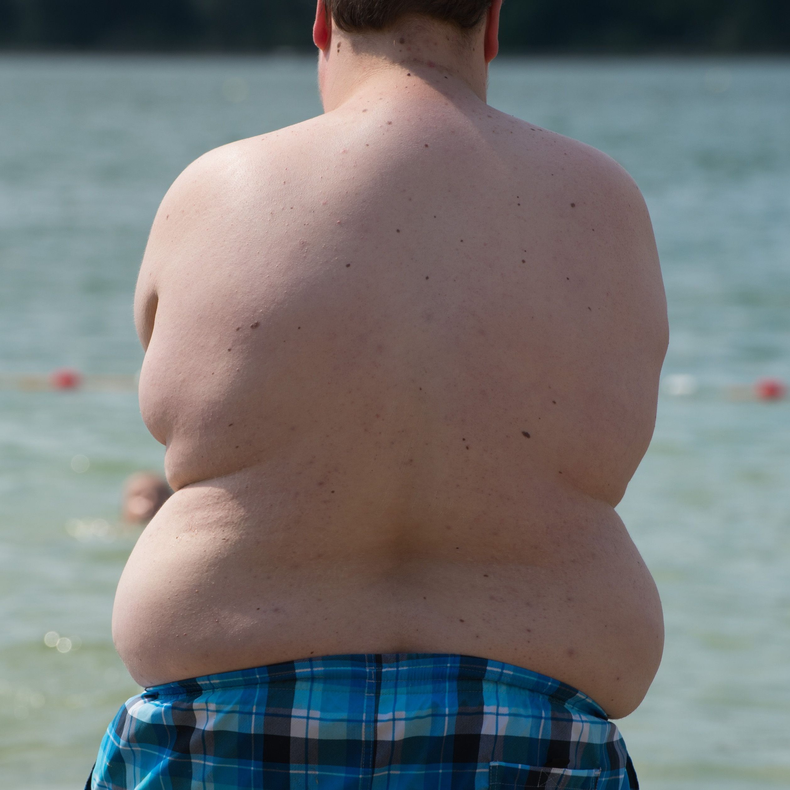 1,2 Millionen Menschen in Österreich leiden an Übergewicht.