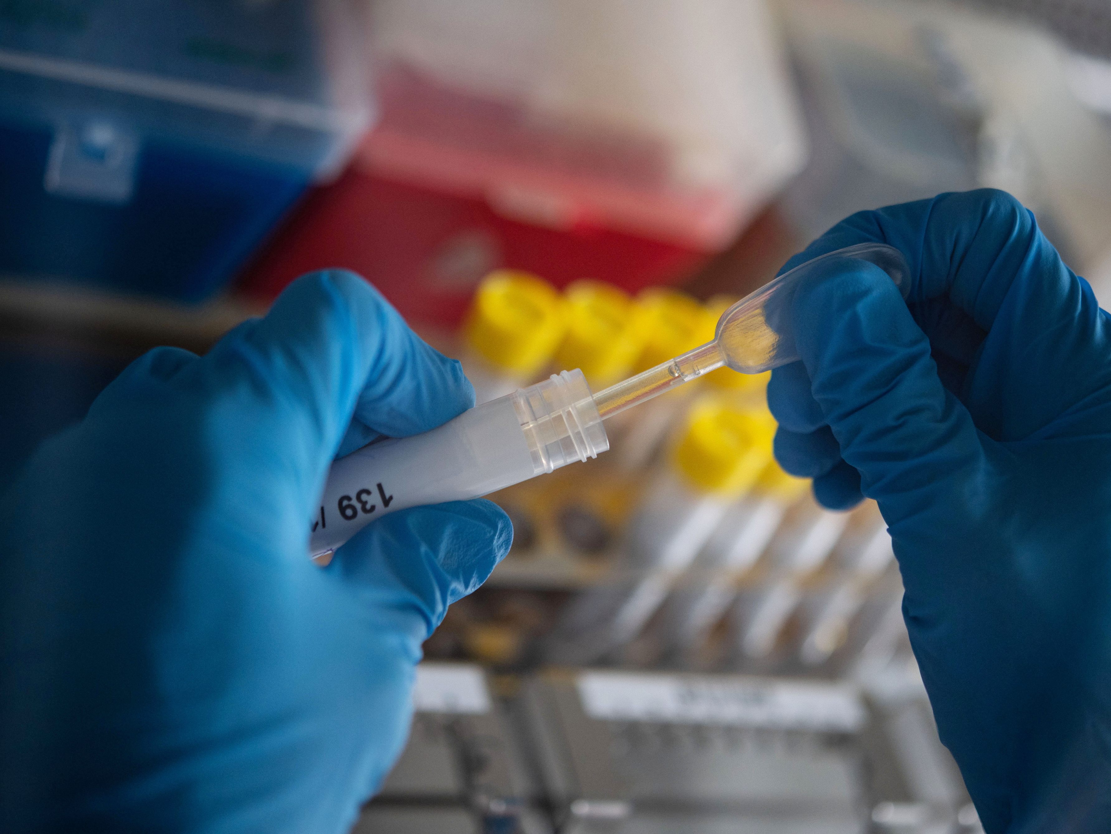 Eine Studie zeigt: Eine hohe Antikörperzahl konnte bie der Delta-Variante eine Corona-Infektion verhindern.