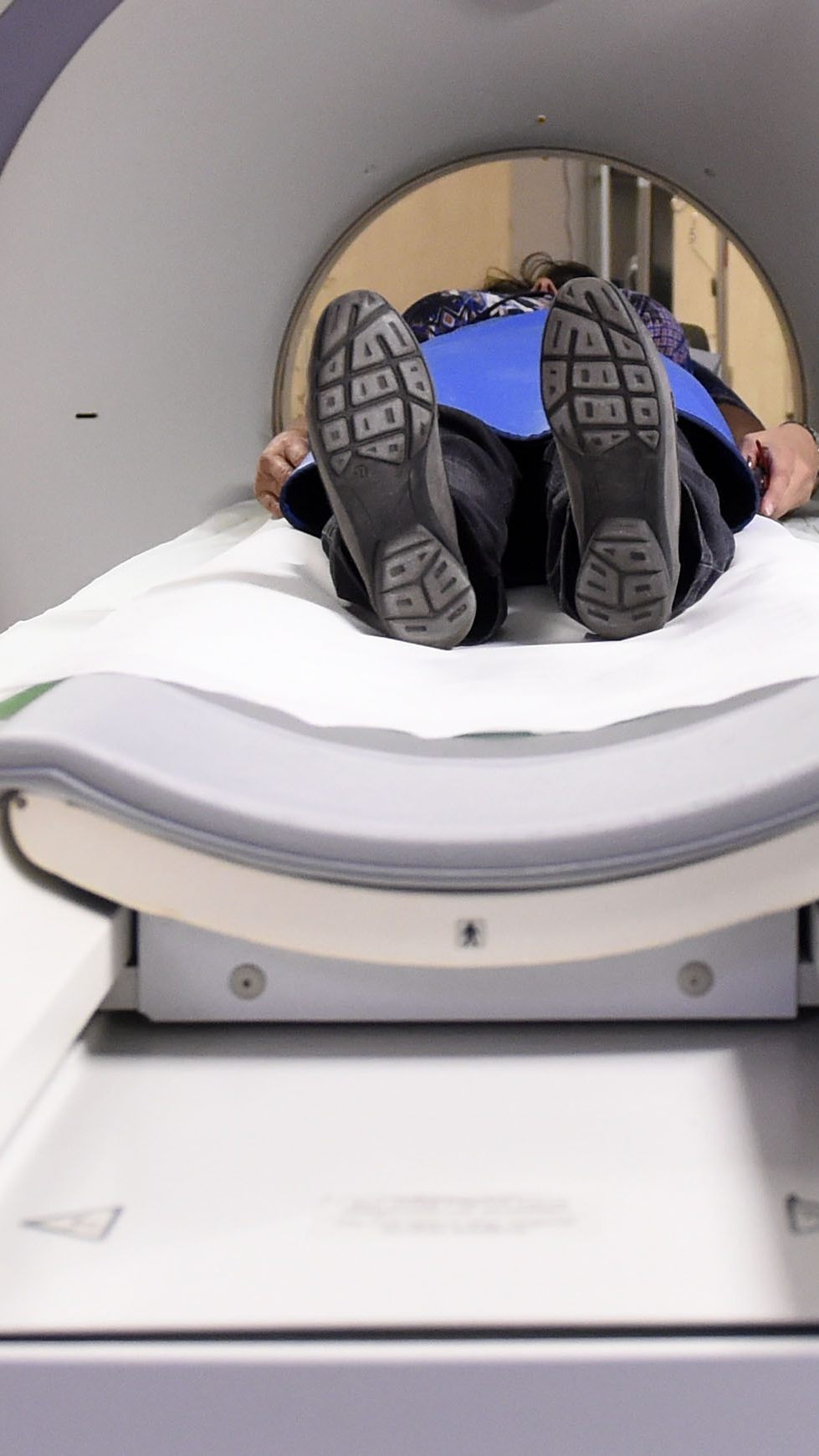 Eine Gruppe besitzt das größte Risiko, auch ein Jahr nach der Corona-Erkrankung noch Lungenveränderungen bei CT-Untersuchungen zu zeigen.