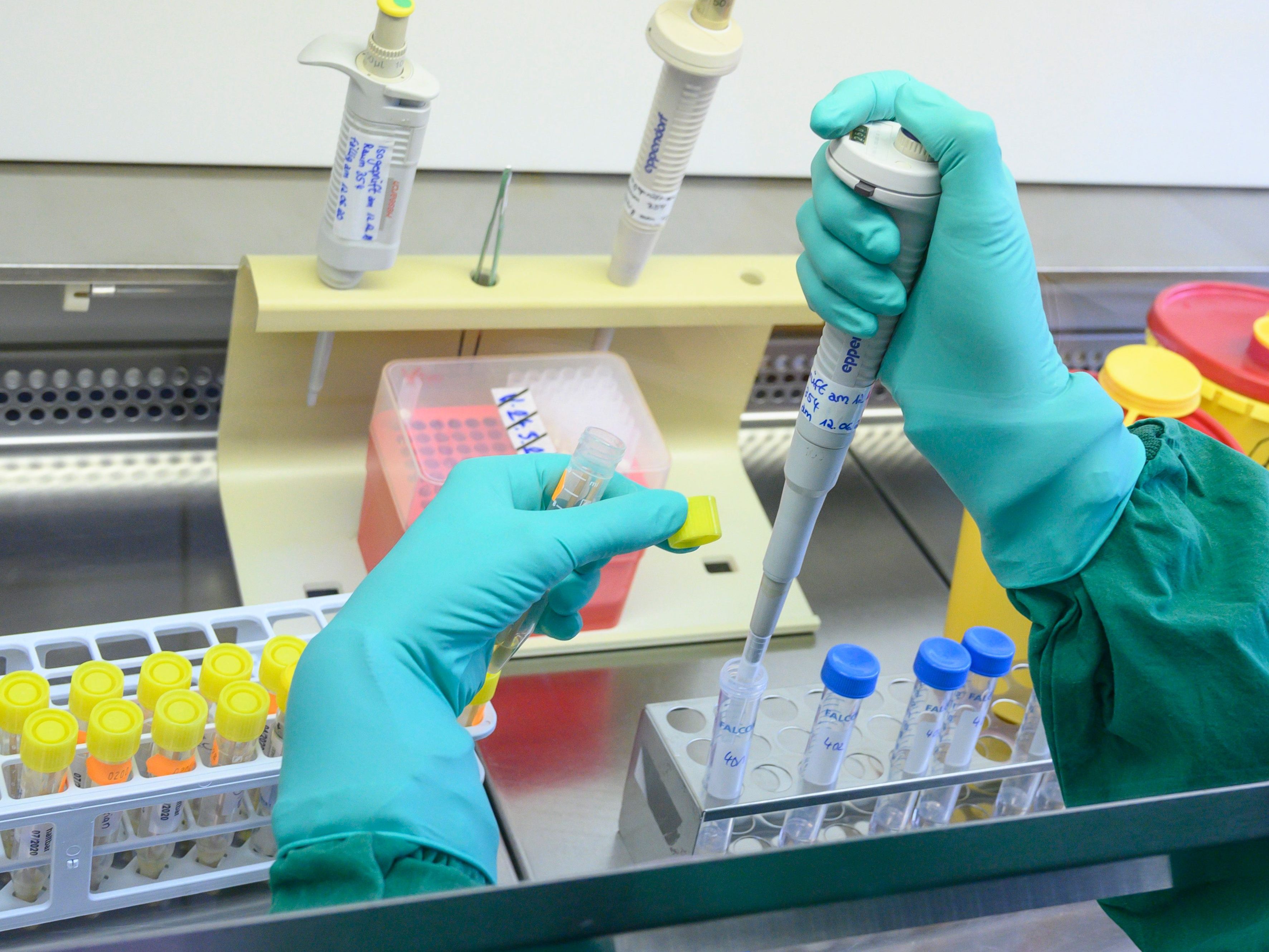 Die EU-Seuchenschutzbehörde ECDC informiert zu Kinder-Hepatitisfällen