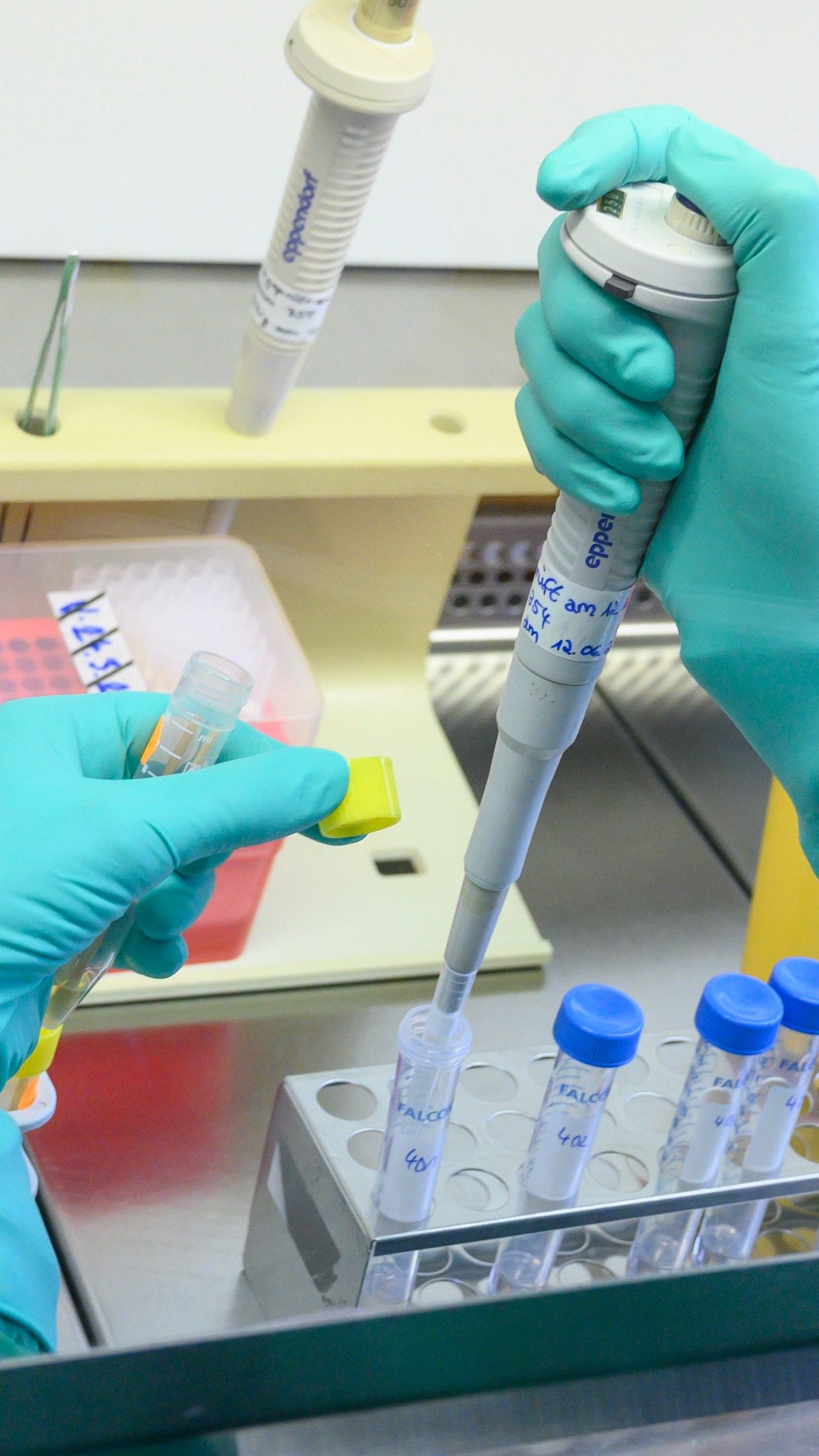 Die EU-Seuchenschutzbehörde ECDC informiert zu Kinder-Hepatitisfällen