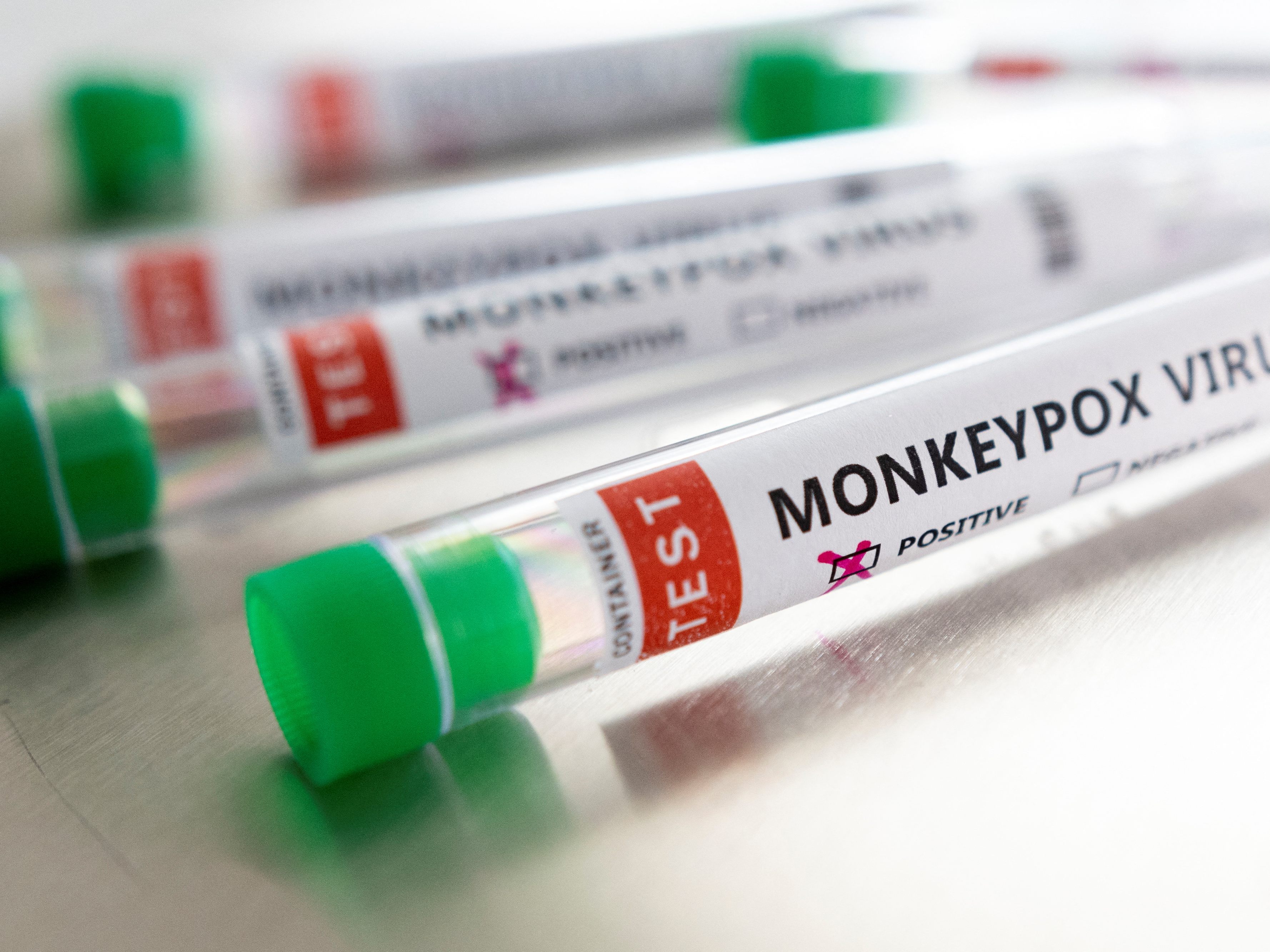 Affenpocken: UNAIDS-Kritik an einigen Berichten.