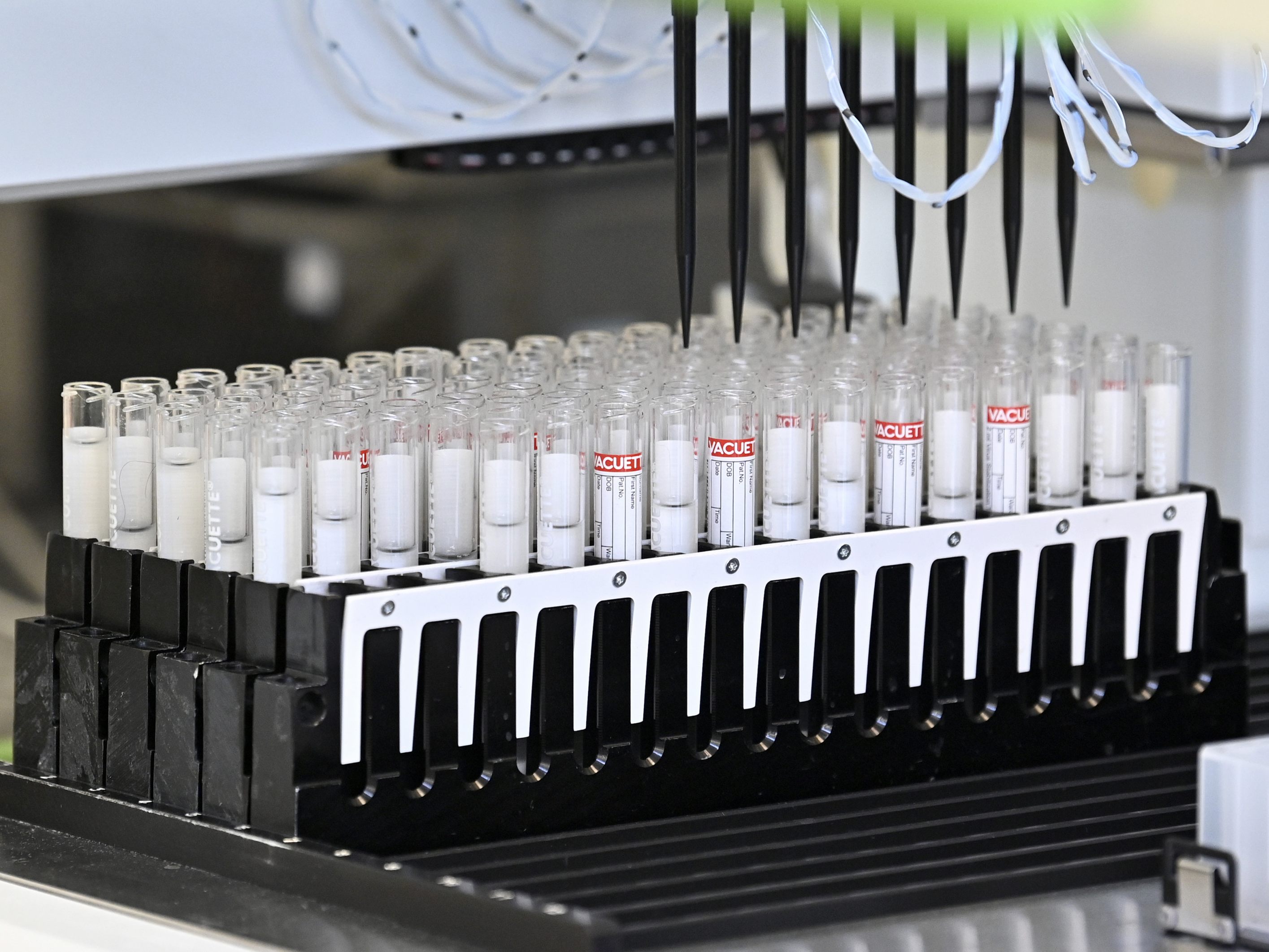 2.177 Corona-Neuinfektionen sind am Dienstag gemeledet worden