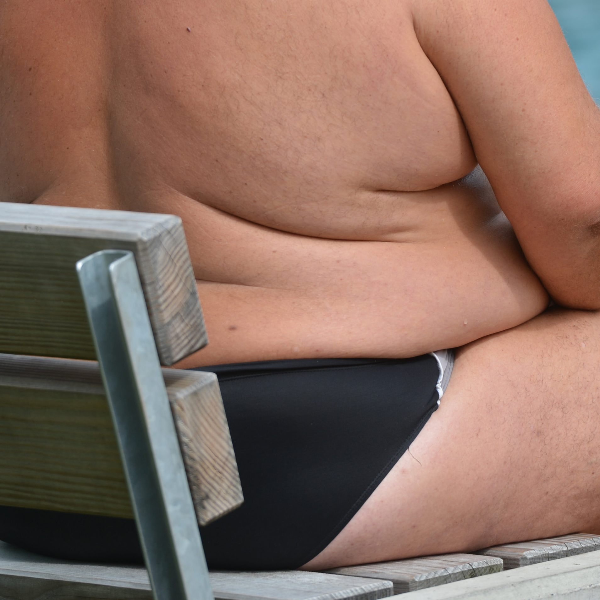 Übergewicht ist auch für die Volkswirtschaft ein Problem.