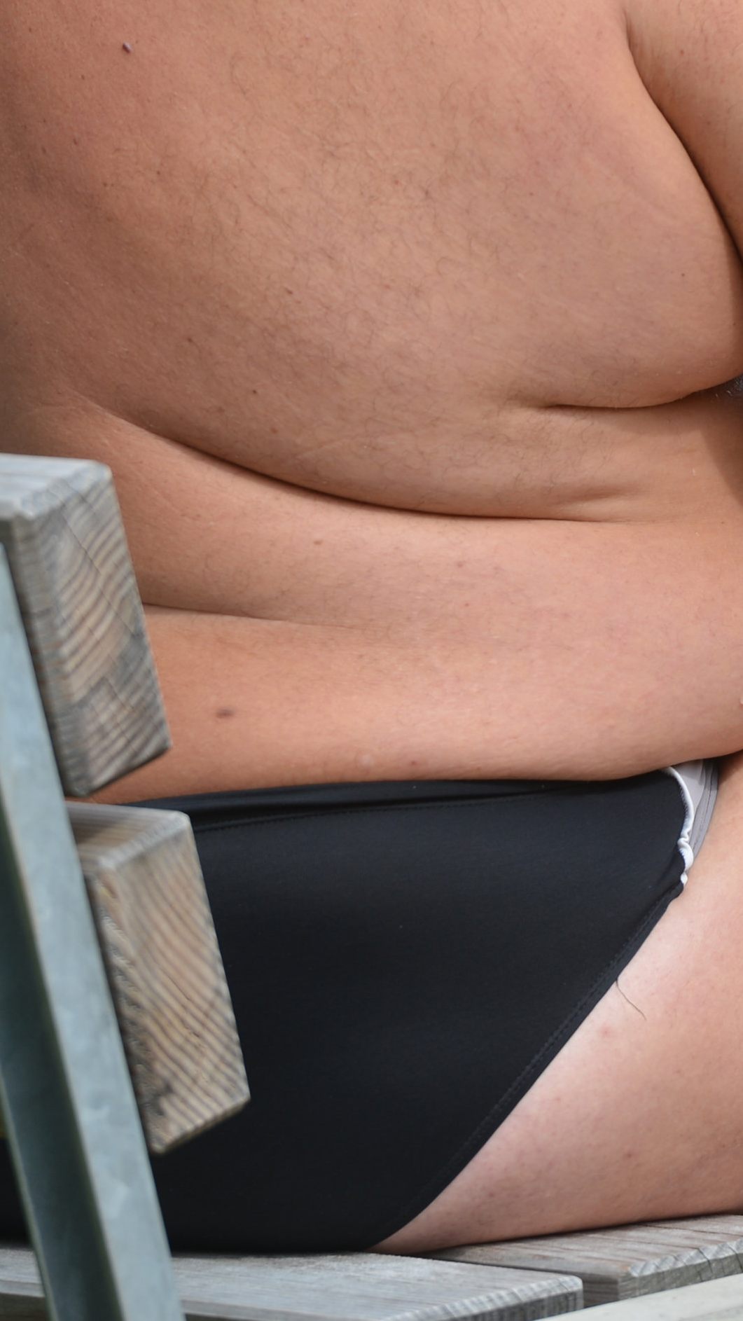 Übergewicht ist auch für die Volkswirtschaft ein Problem.