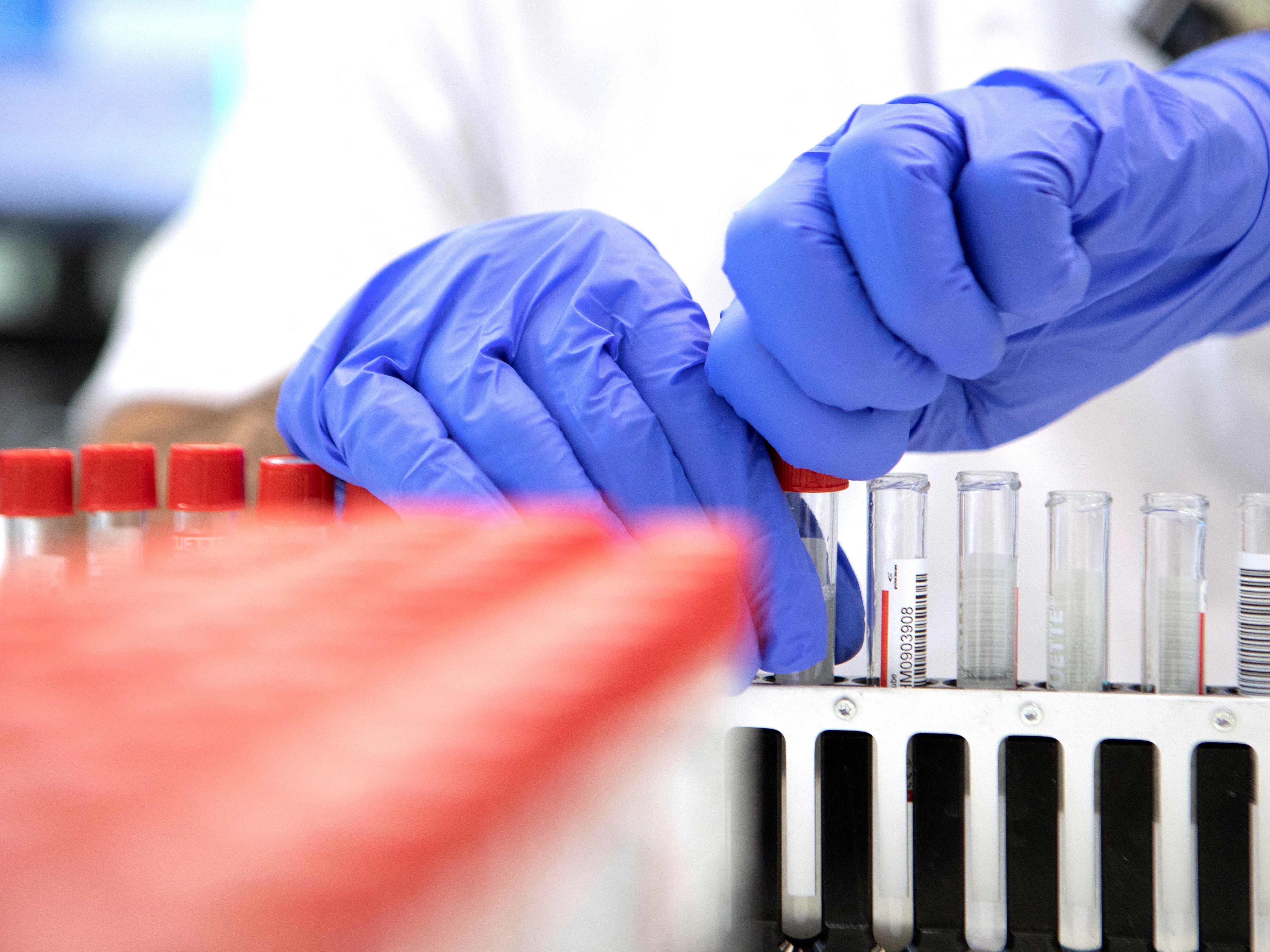 Das Corona-Prognosekonsortium rechnet auch kommende Woche mit sinkenden Fallzahlen. Das Corona-Prognosekonsortium rechnet auch kommende Woche mit sinkenden Fallzahlen.