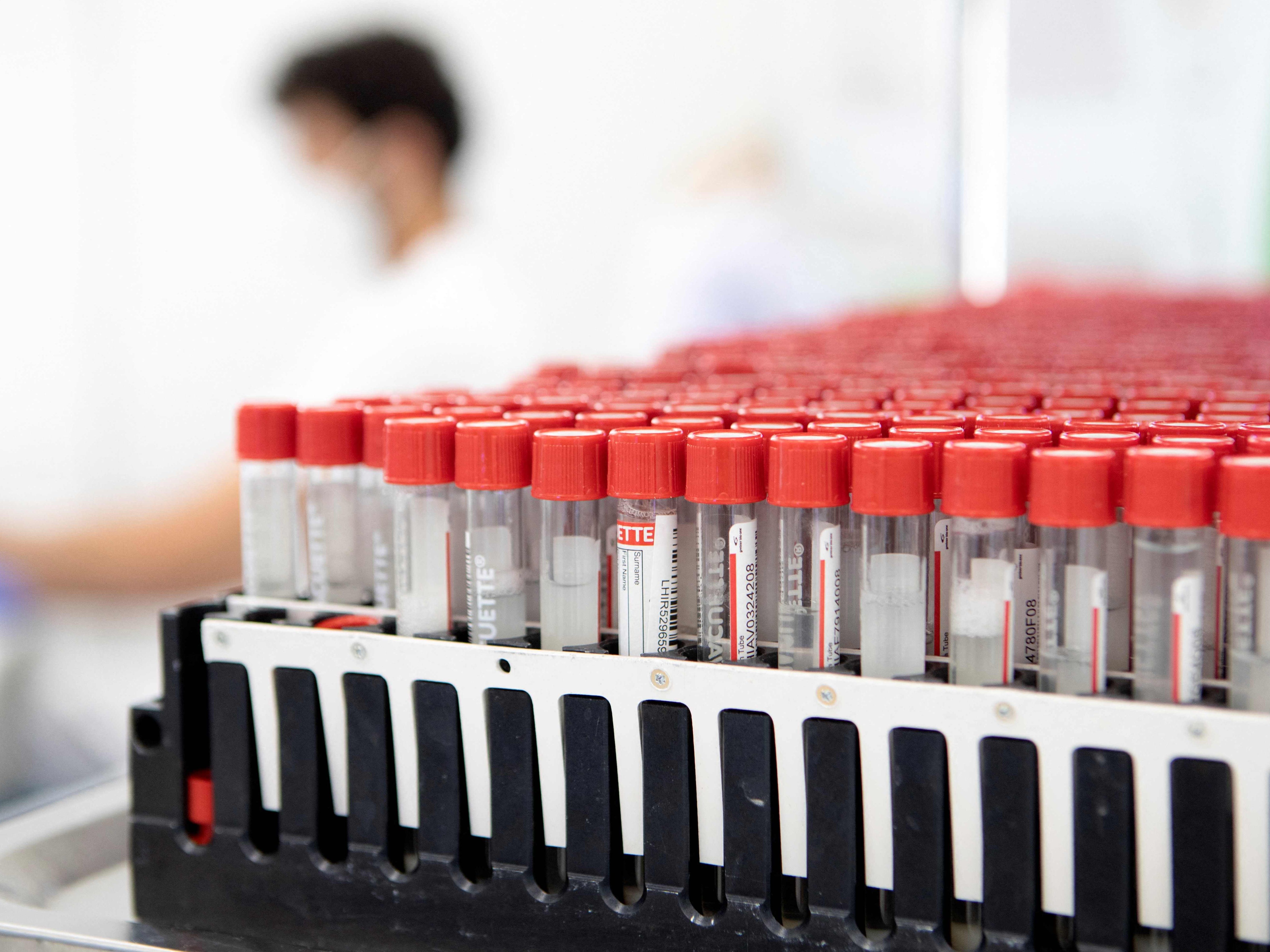 In Österreich wurden am Freitag 4.555 Neuinfektionen mit dem Coronavirus gemeldet. In Österreich wurden am Freitag 4.555 Neuinfektionen mit dem Coronavirus gemeldet.