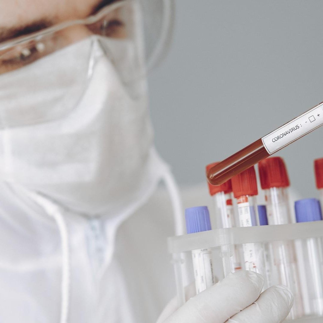 Corona-Lage in Österreich