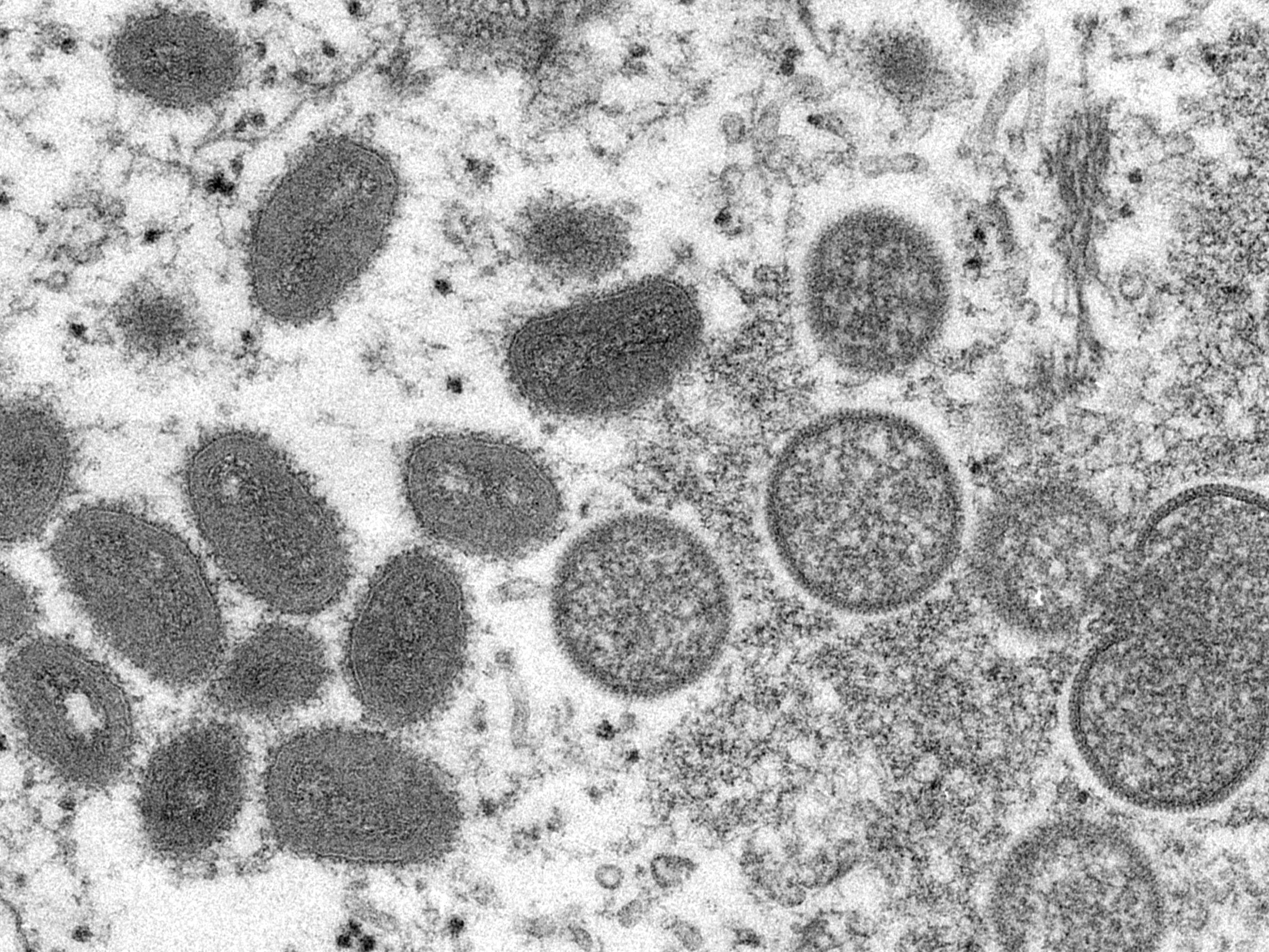 Britische Behörde: Drei Wochen Quarantäne bei Kontakt mit Affenpocken-Infizierten.