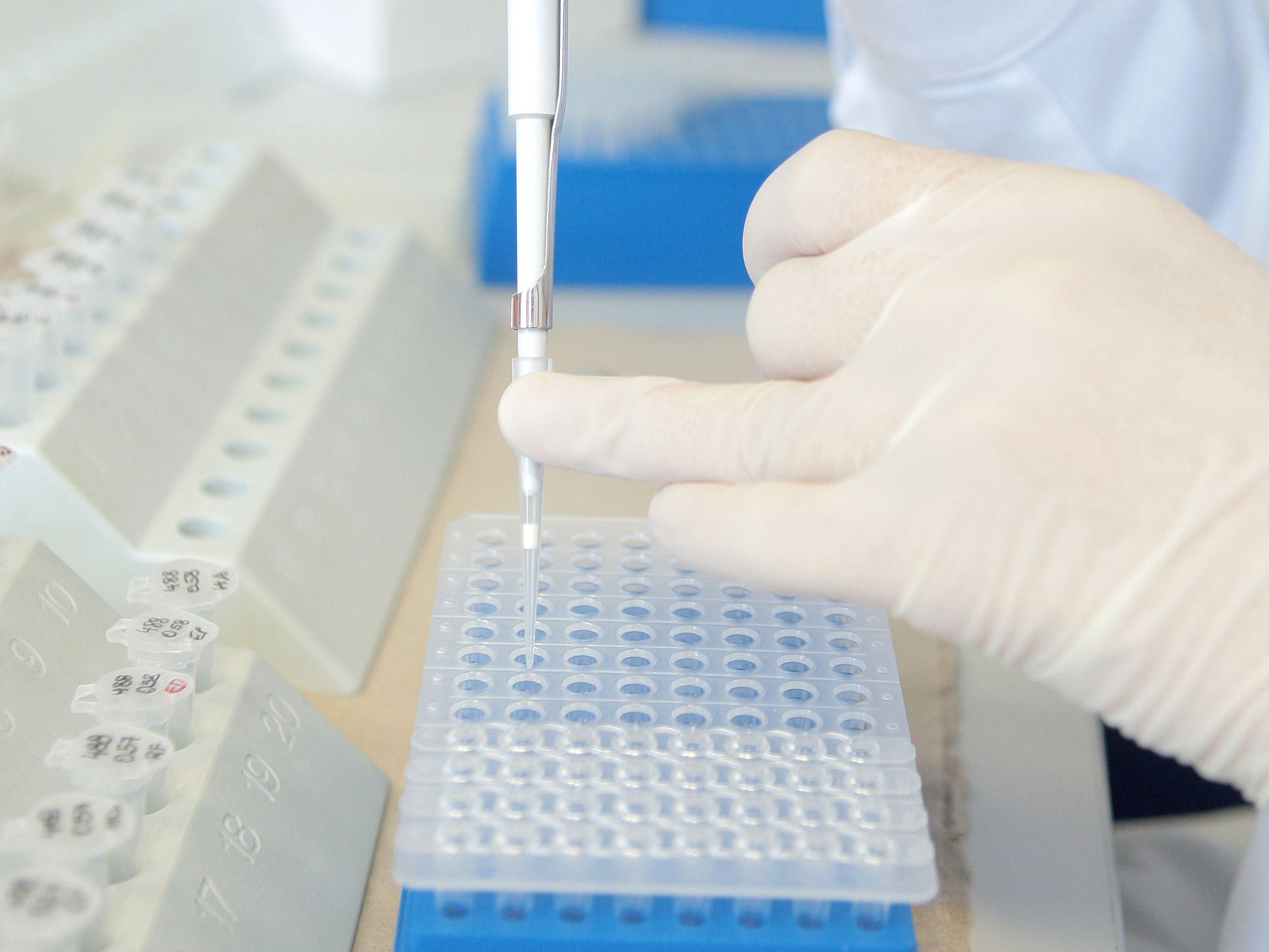 WHO-Experten fordern die Prüfung der Laborthese zum Ursprung des Coronavirus. WHO-Experten fordern die Prüfung der Laborthese zum Ursprung des Coronavirus.