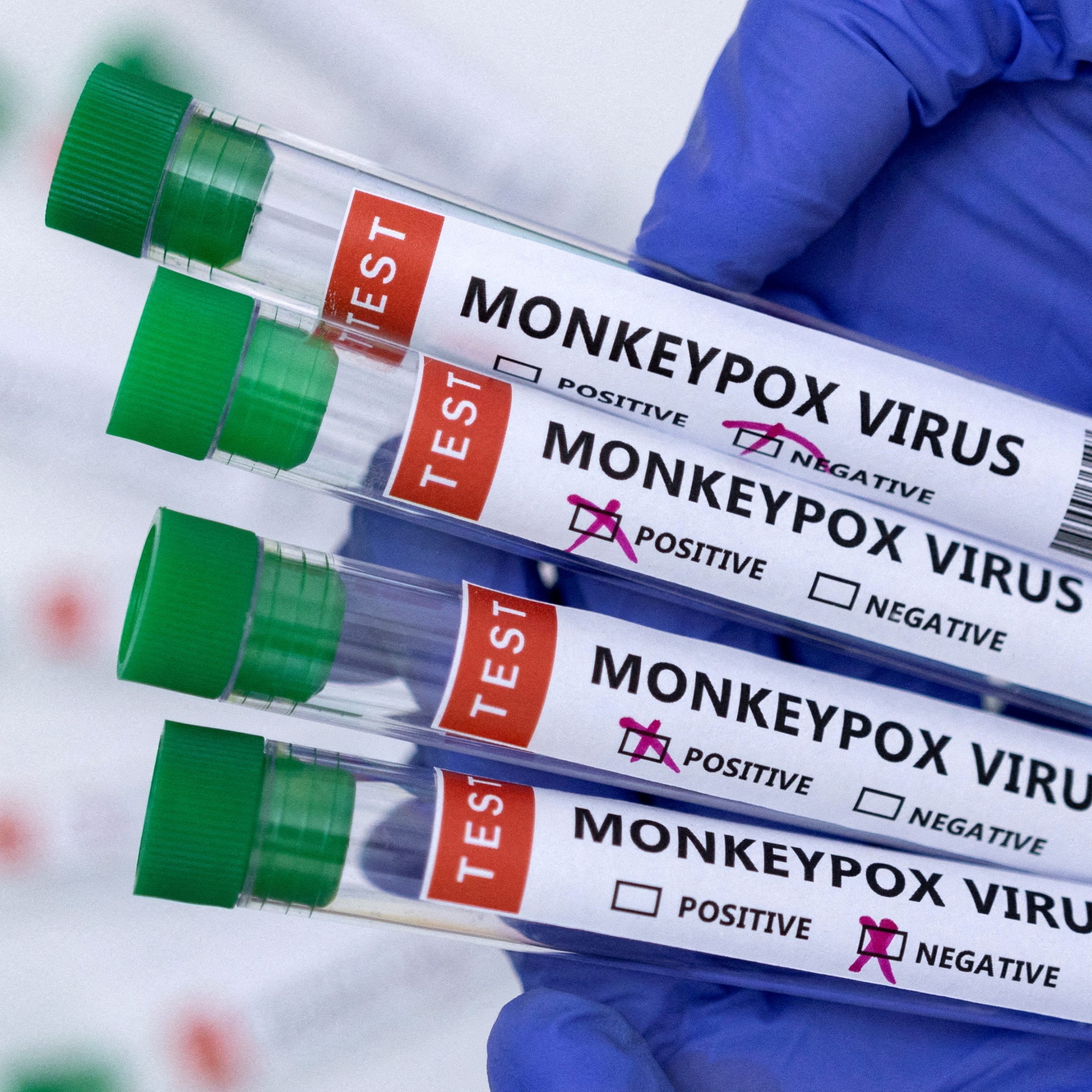 Sieben neue Fälle der Affenpocken wurden am Freitag in Österreich gemeldet.