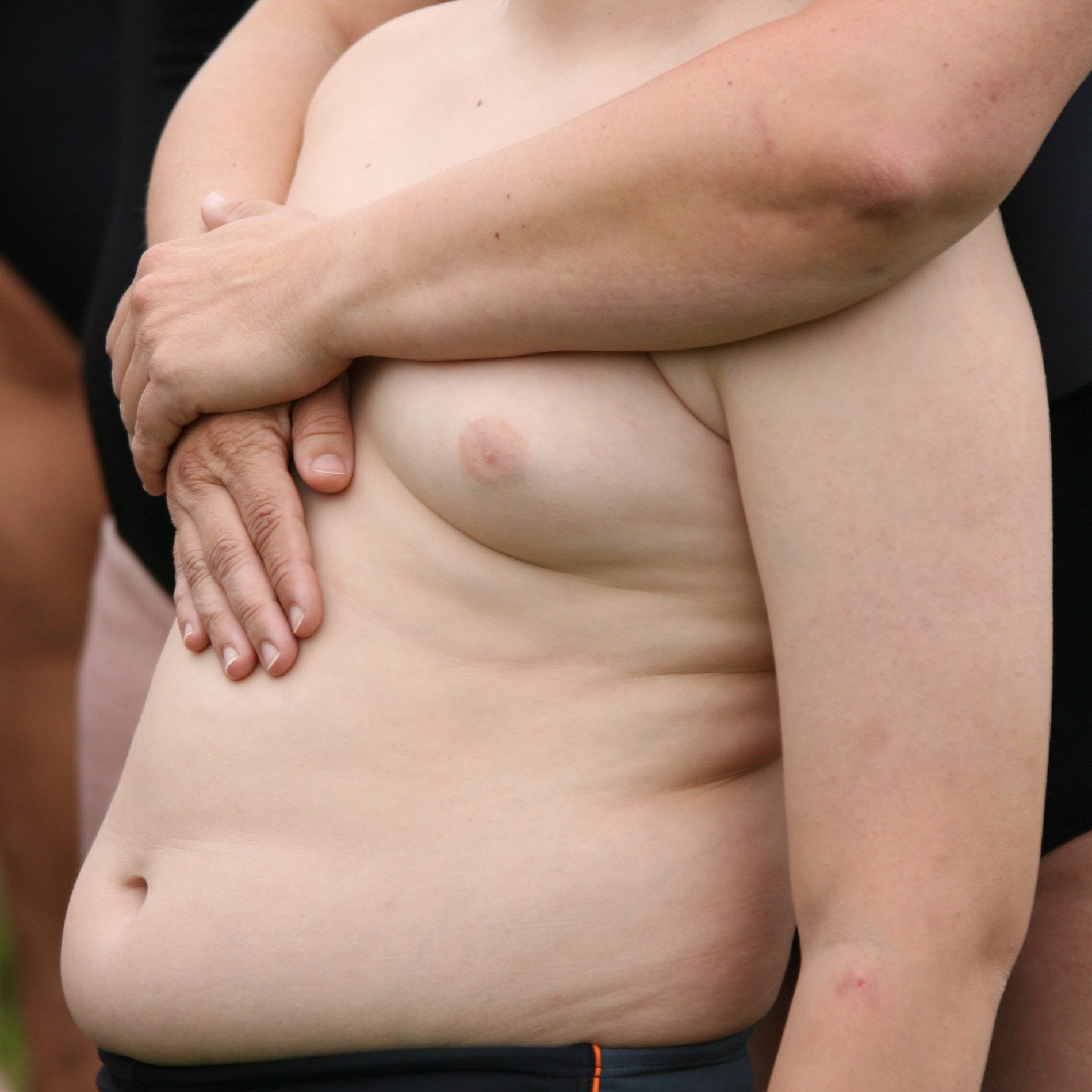 Immer mehr Kinder und Jugendliche leiden an Typ-1-Diabetes.