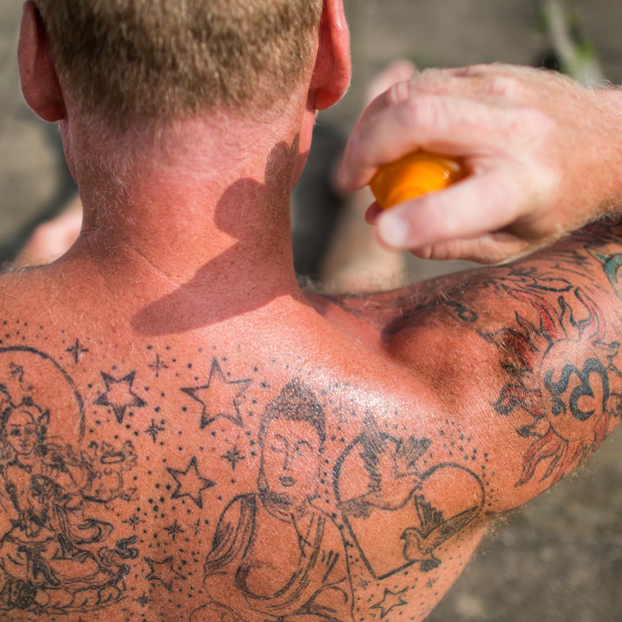 So können Sie einen Sonnenbrand vermeiden bzw behandeln.