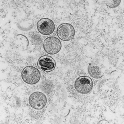 Bei den Affenpocken handelt es sich um eine weniger gefährliche Variante der vor 40 Jahren ausgerottetenPocken.