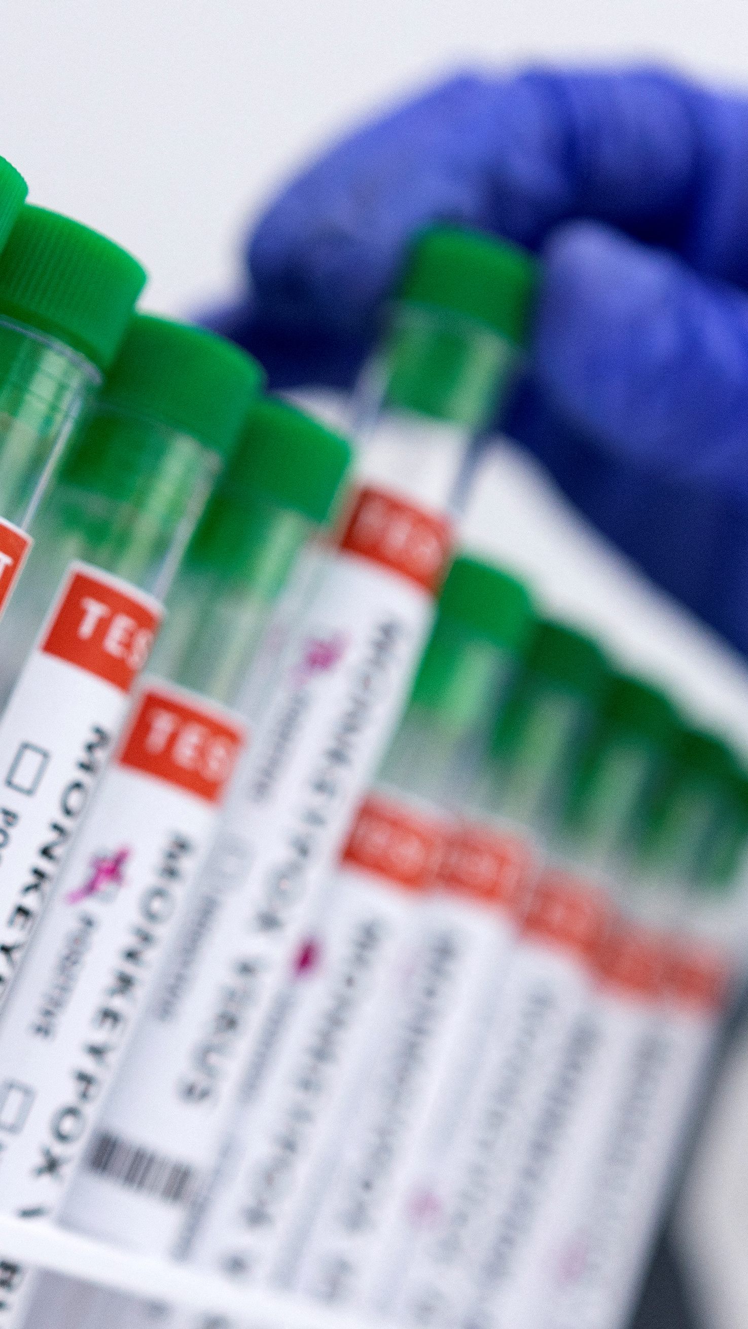 Die Zahl der Affenpocken-Fälle in Wien steigt.