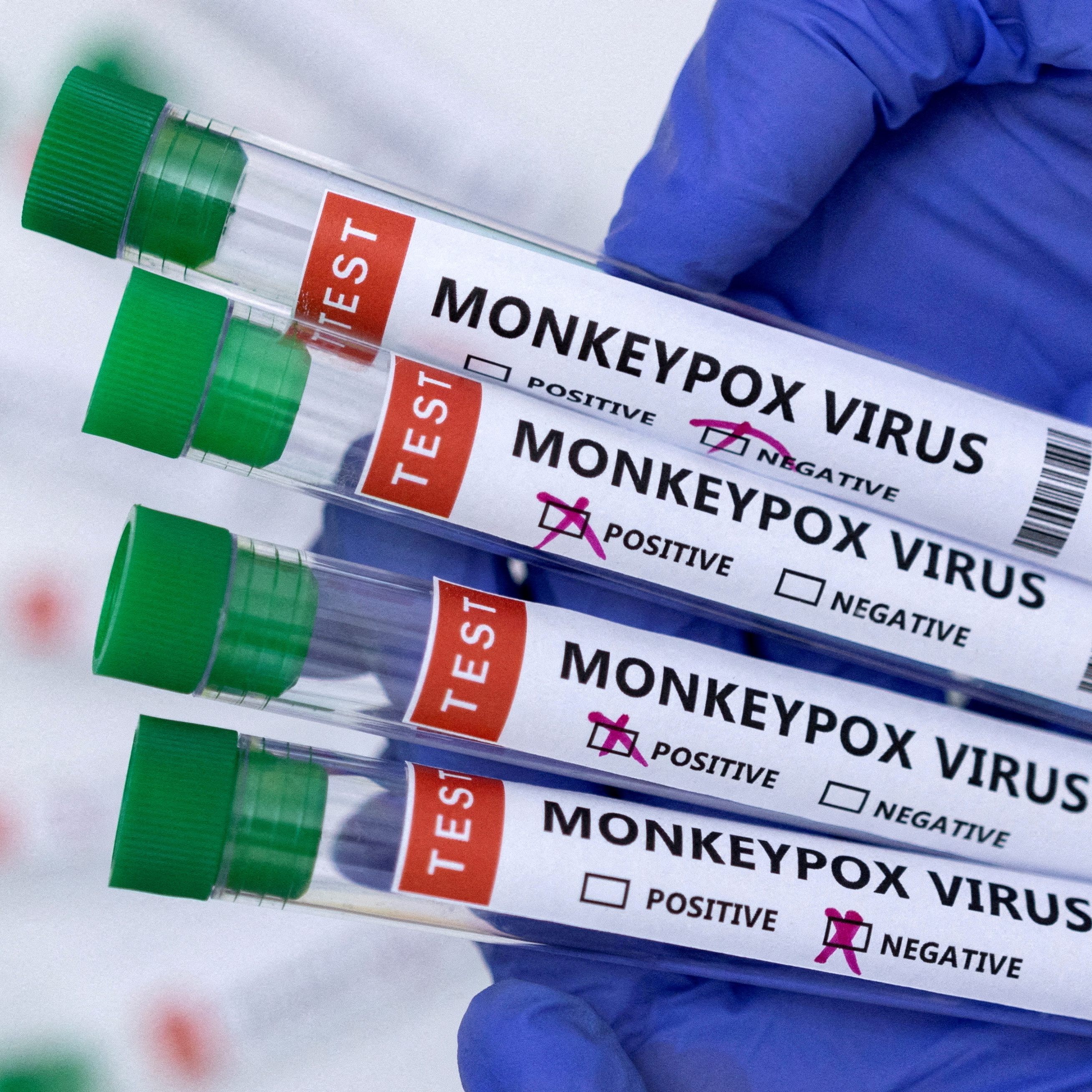 Die Zahl der Affenpocken-Fälle in Österreich ist auf 62 angestiegen.