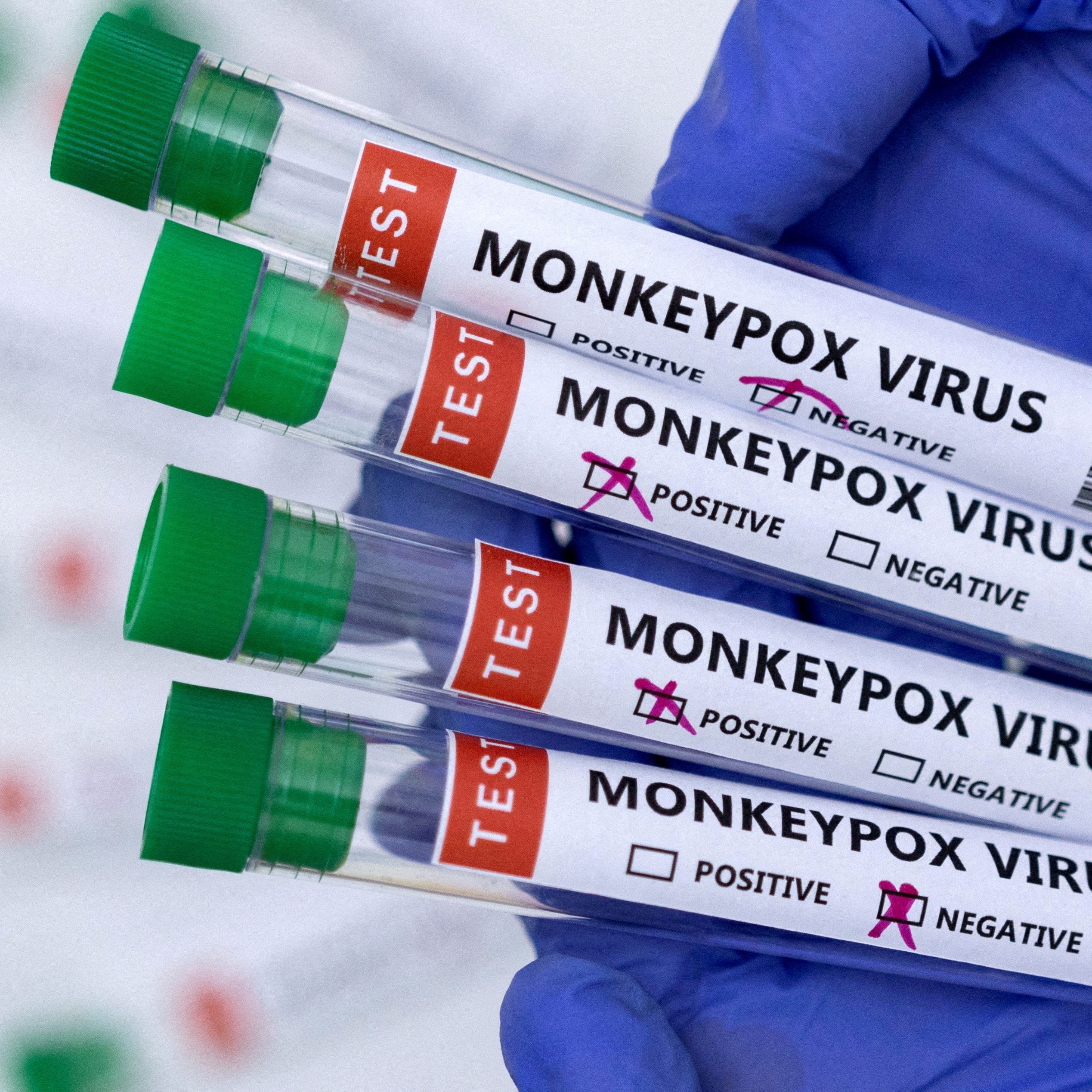 Dieses Affenpocken-Frühsymptom sollte jeder kennen.