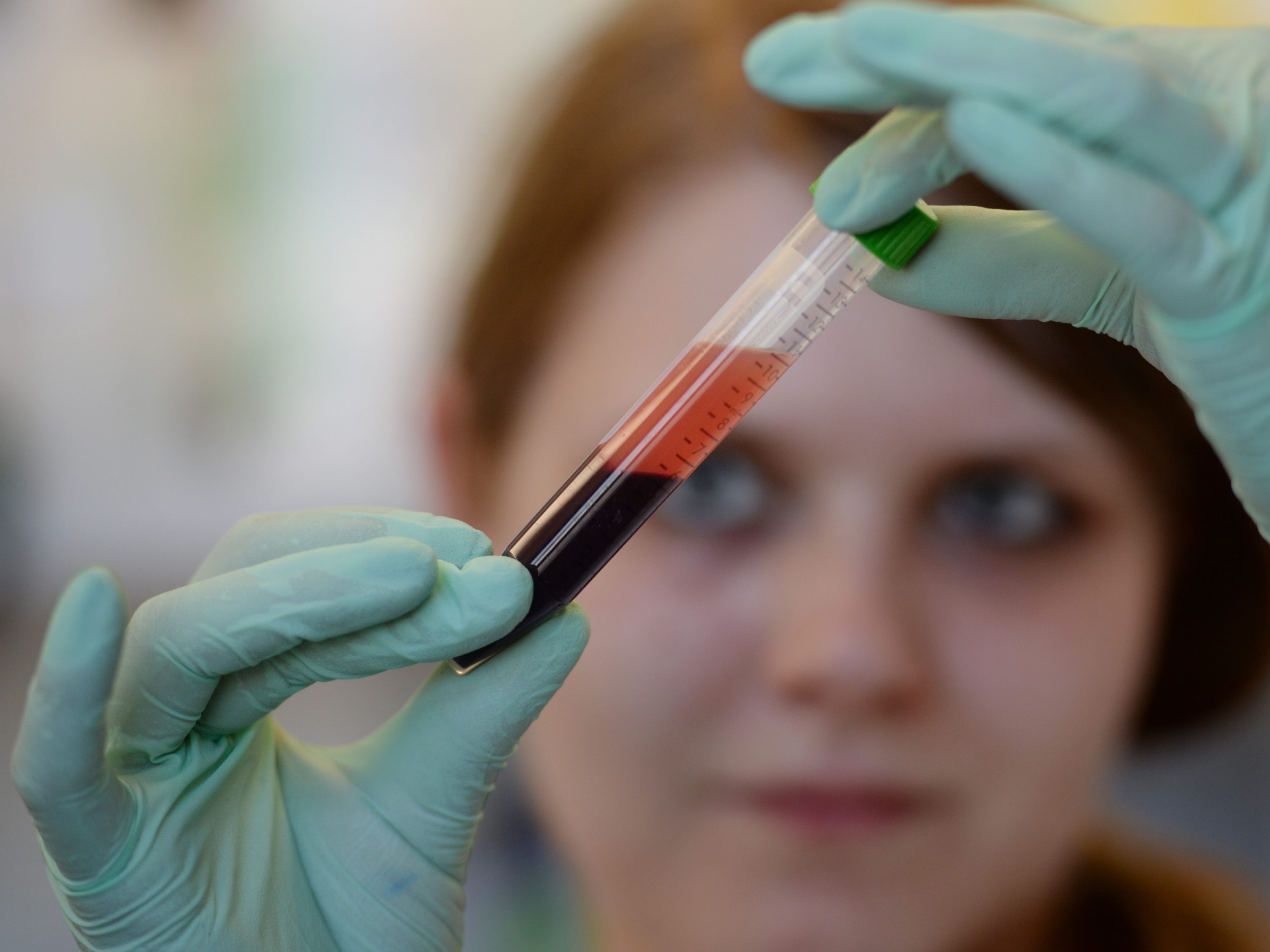 Ab September ist ein neuer Bluttest zu Corona-Immunität an der MedUni Wien verfügbar Ab September ist ein neuer Bluttest zu Corona-Immunität an der MedUni Wien verfügbar