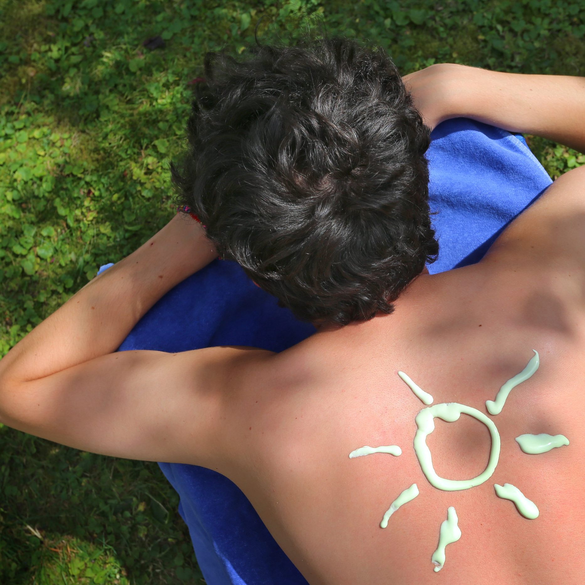 Diese Tipps helfen wirklich bei Sonnenbrand.