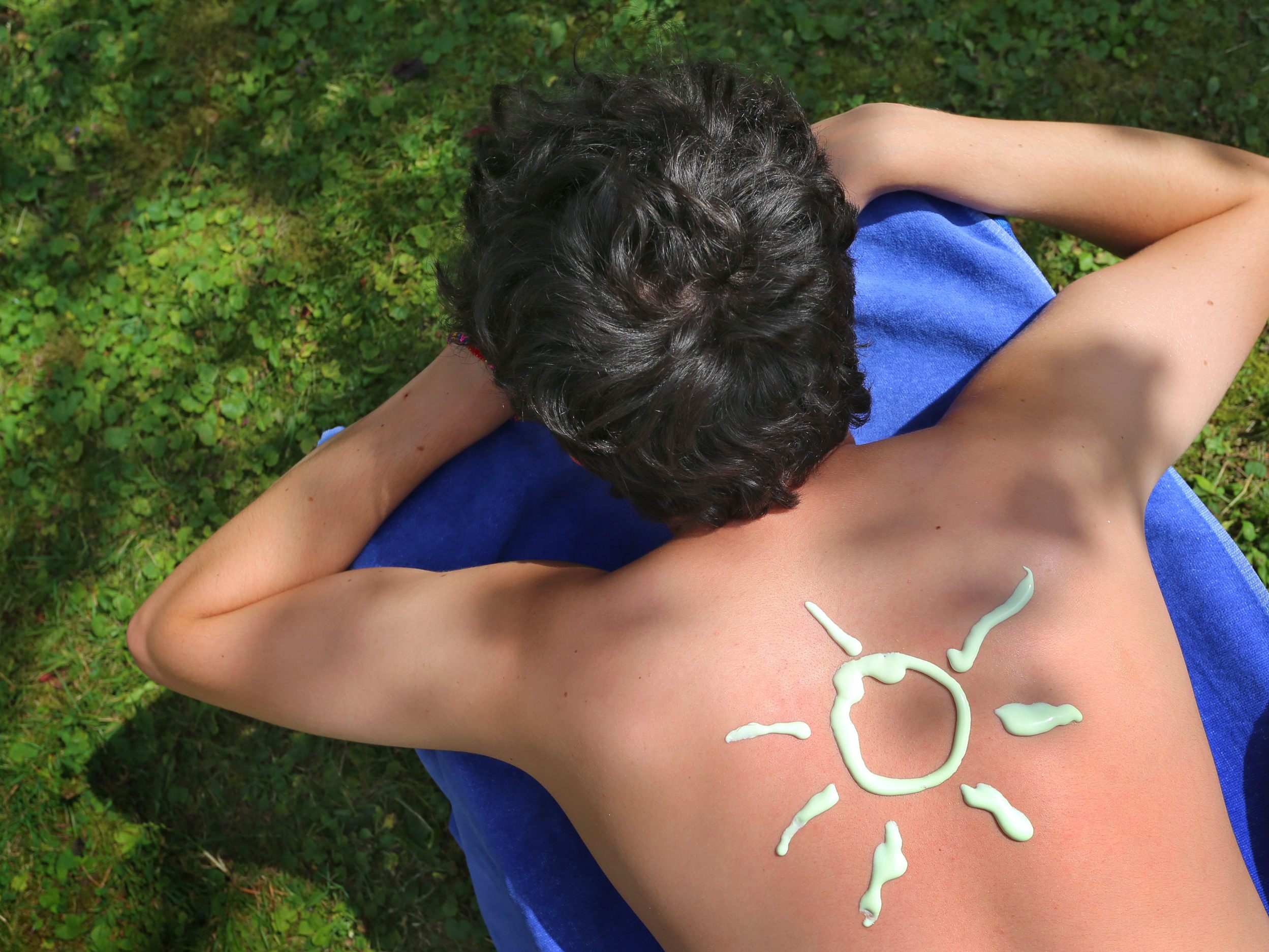 Diese Tipps helfen wirklich bei Sonnenbrand.